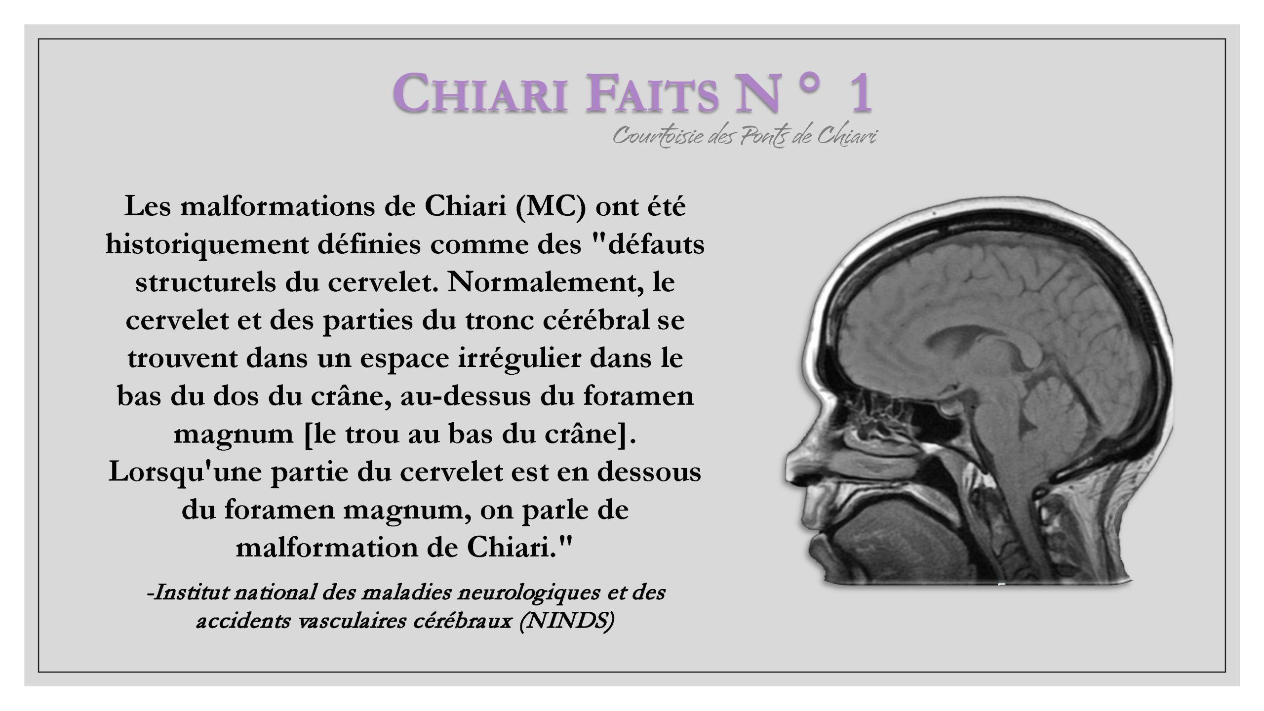 Chiari Faits N ° 1