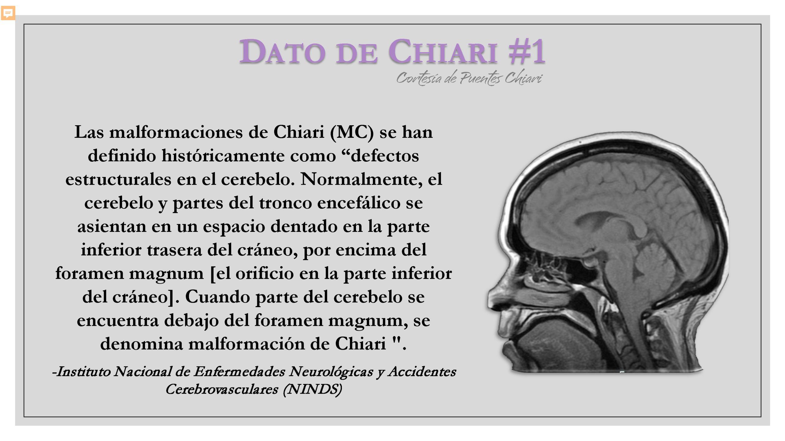 Dato de Chiari #1