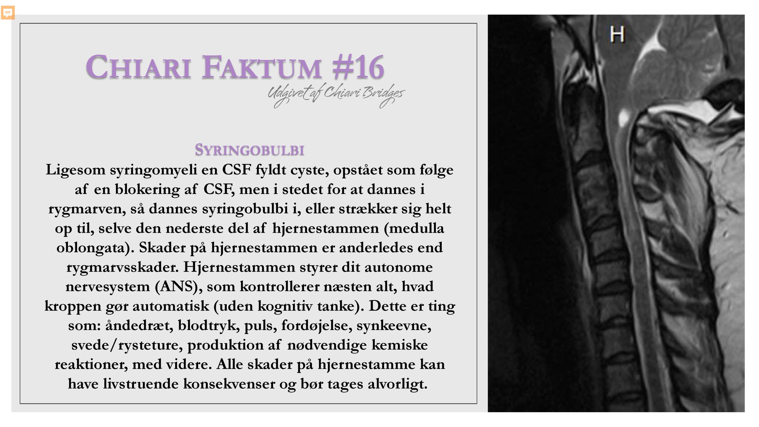 Chiari Faktum #16