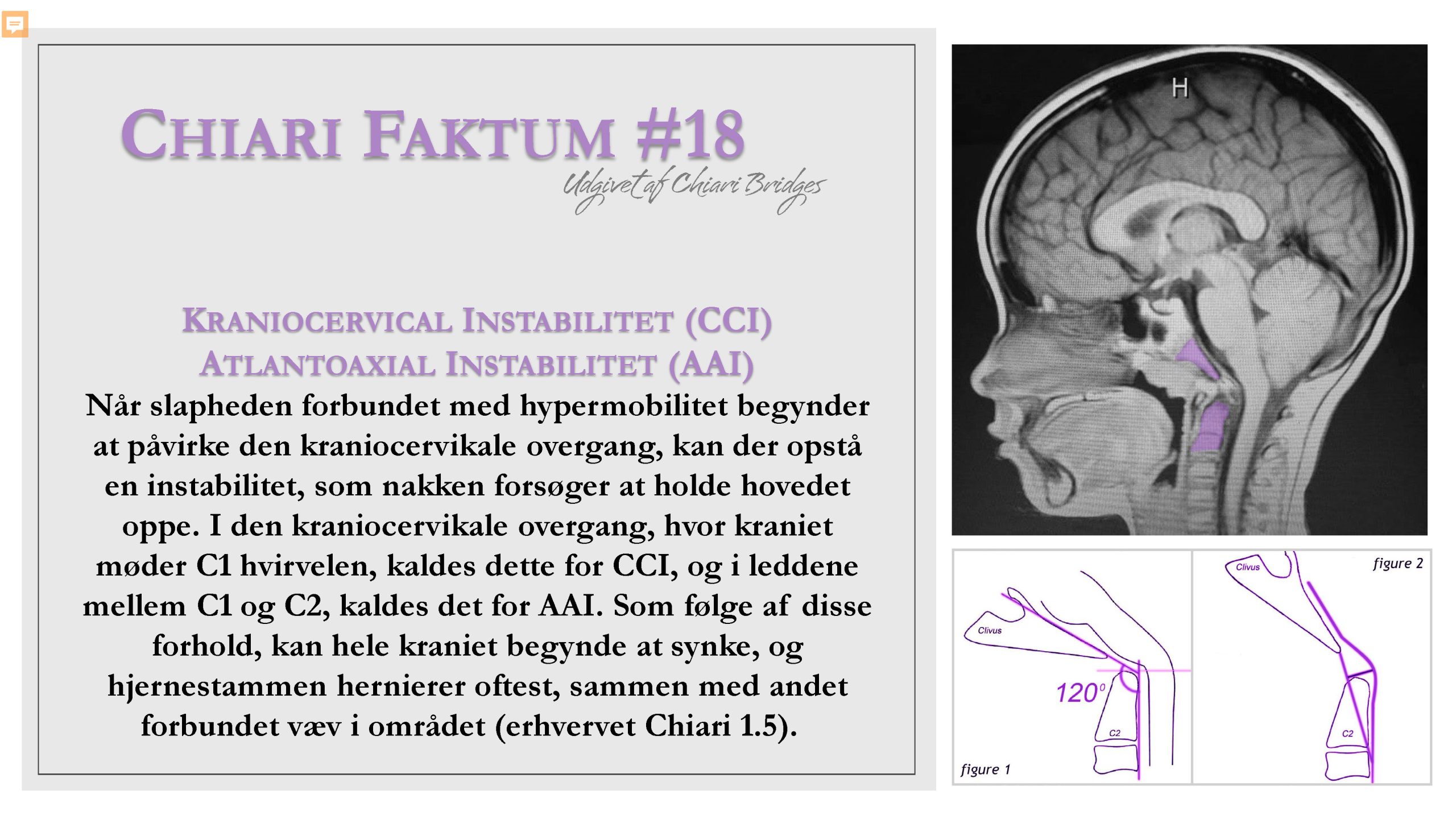 Chiari Faktum #18