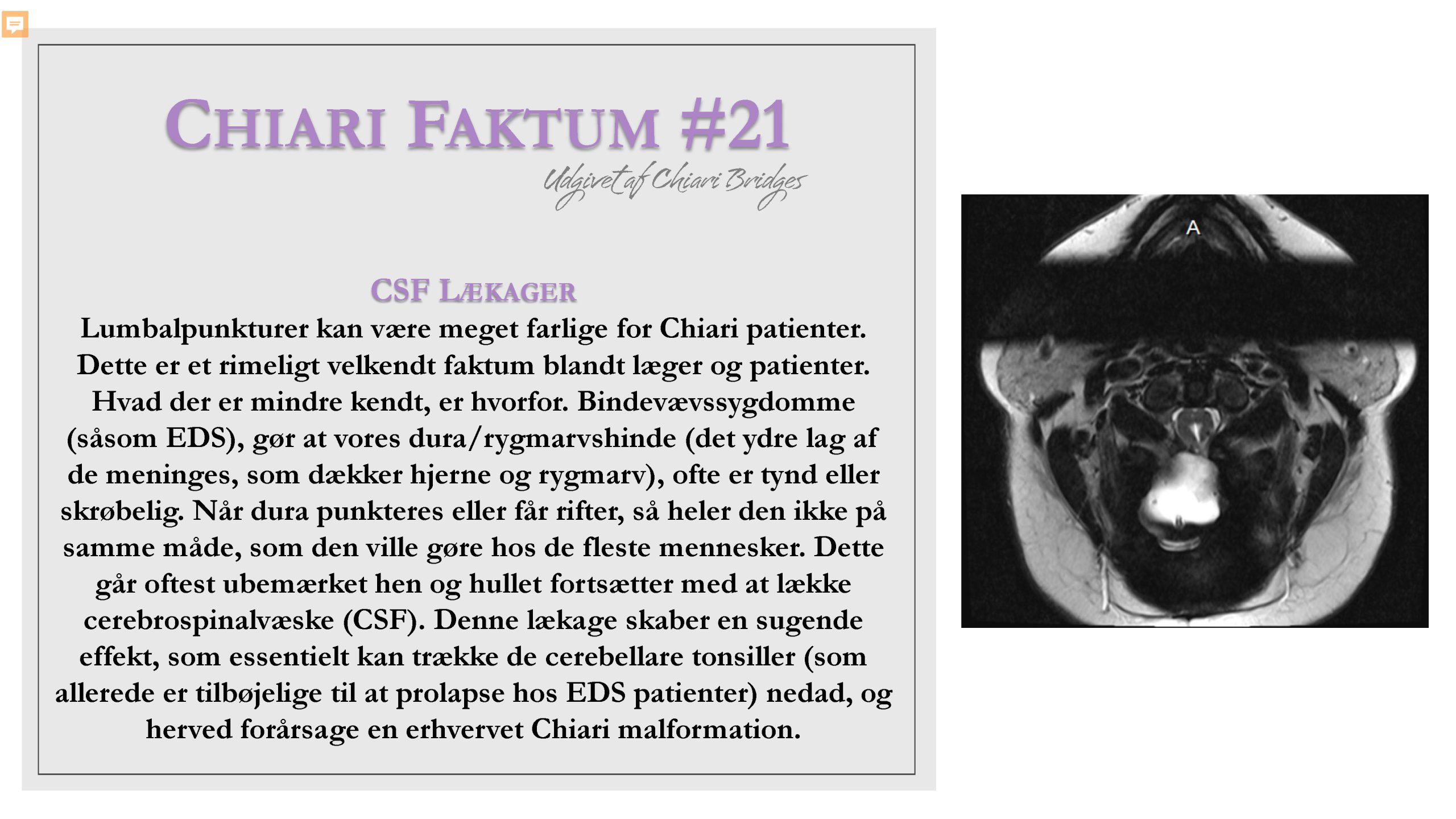 Chiari Faktum #21