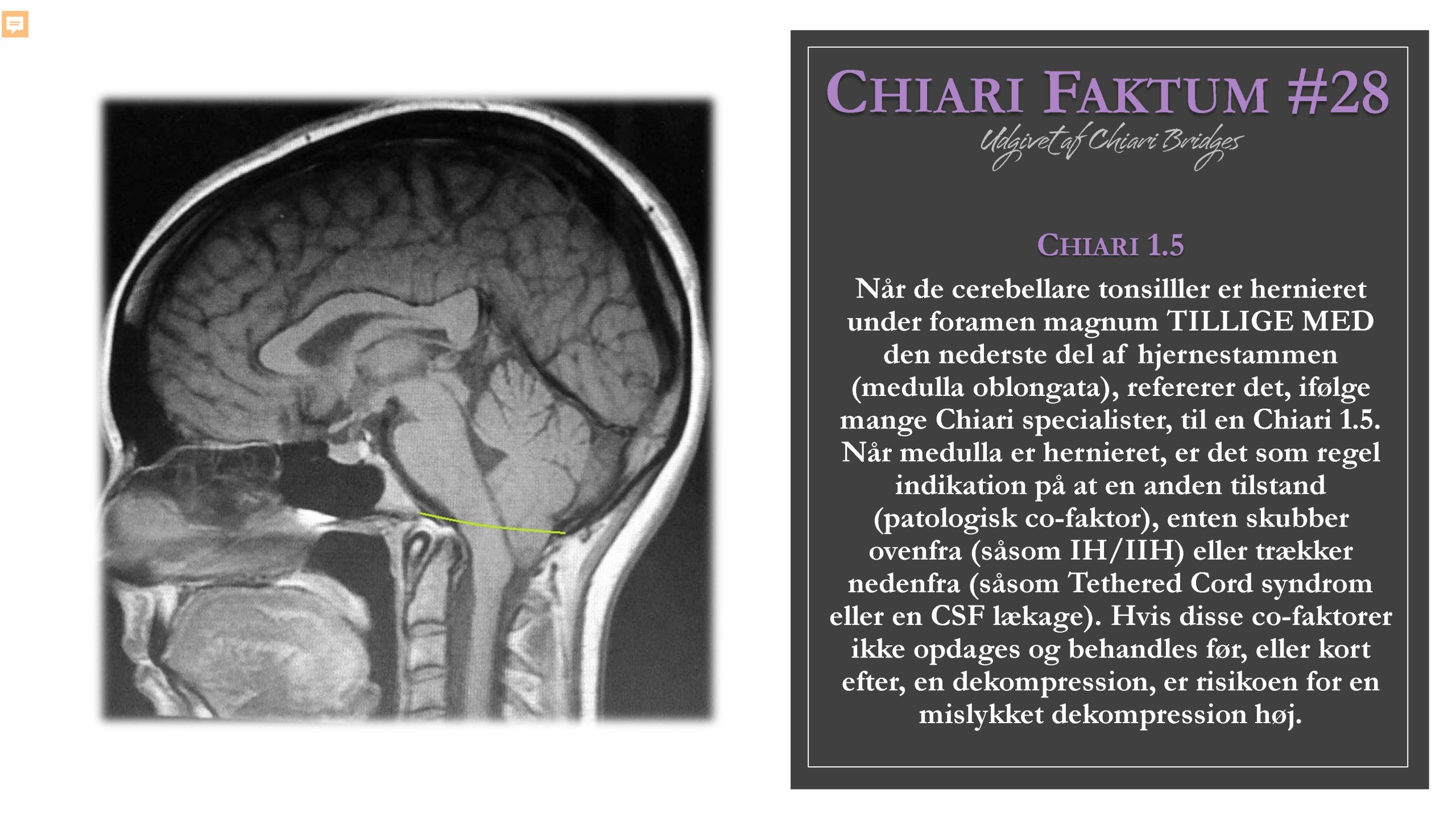 Chiari Faktum #28