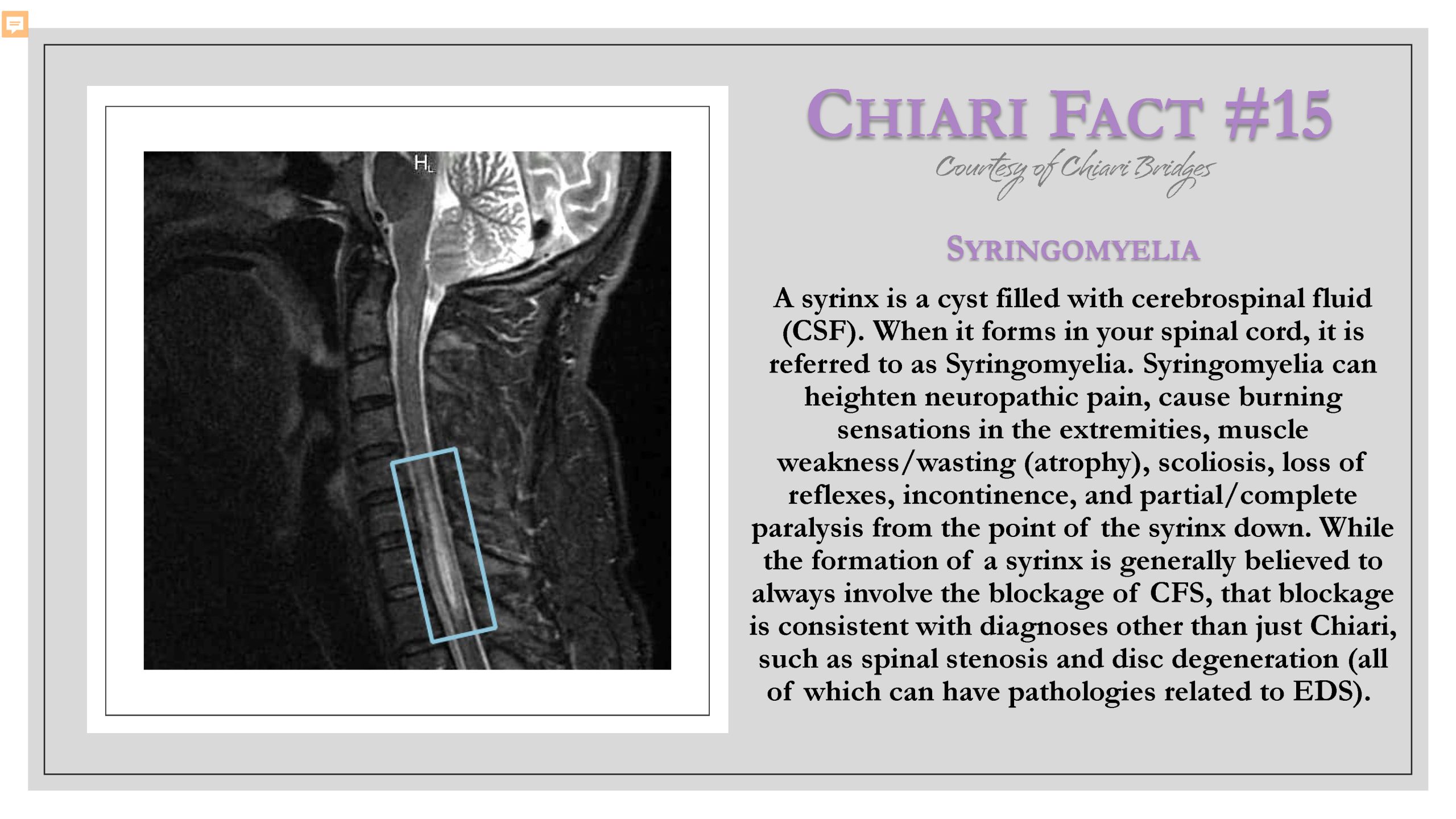 Chiari Fact #15