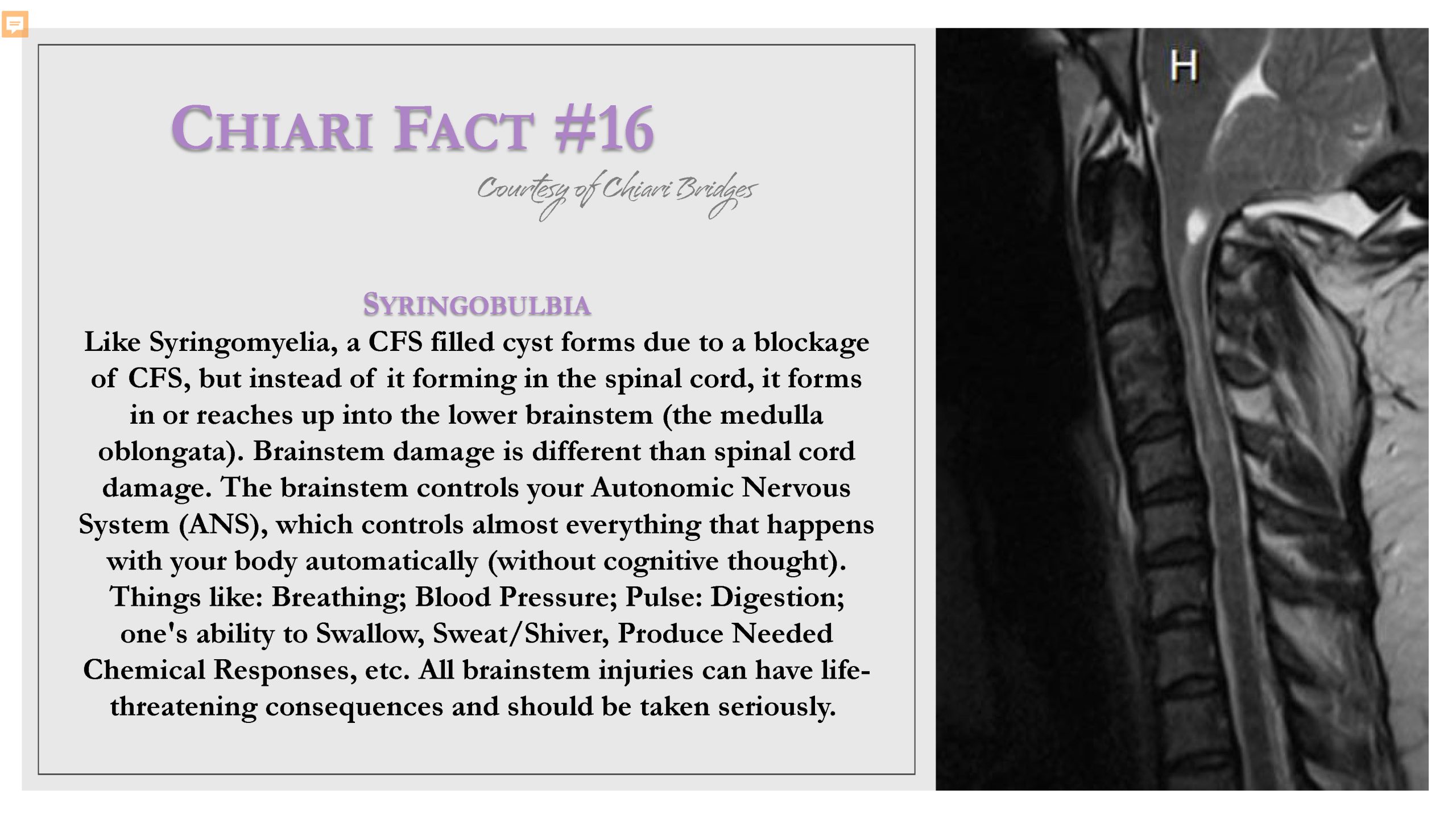 Chiari Fact #16