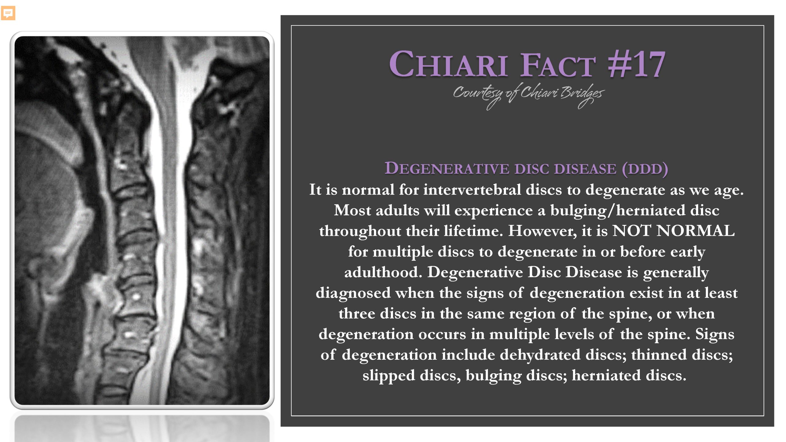 Chiari Fact #17