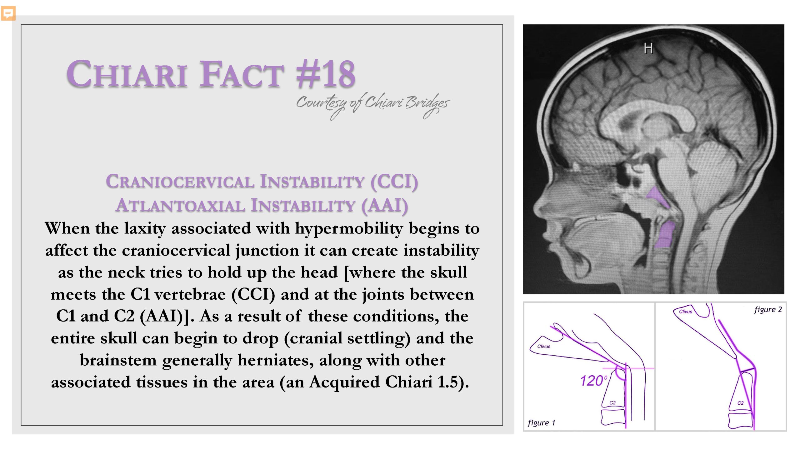 Chiari Fact #18