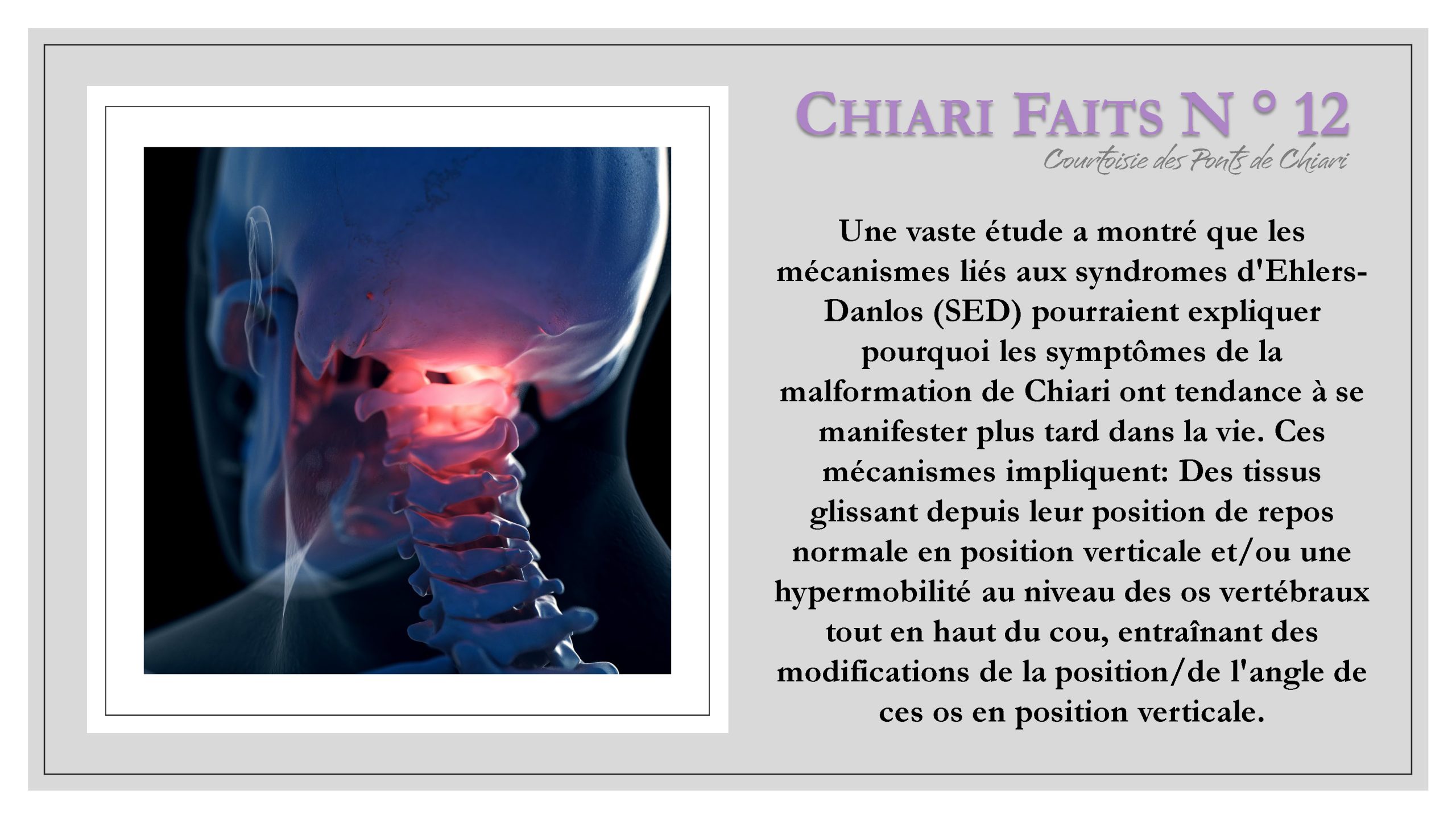 Chiari Faits N ° 12