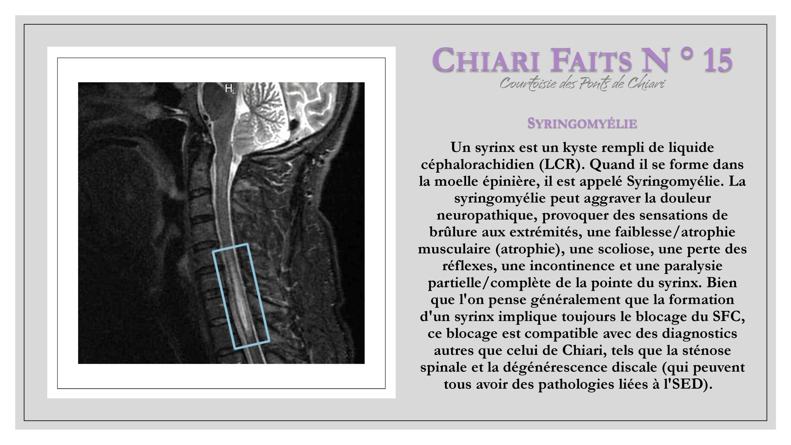 Chiari Faits N ° 15