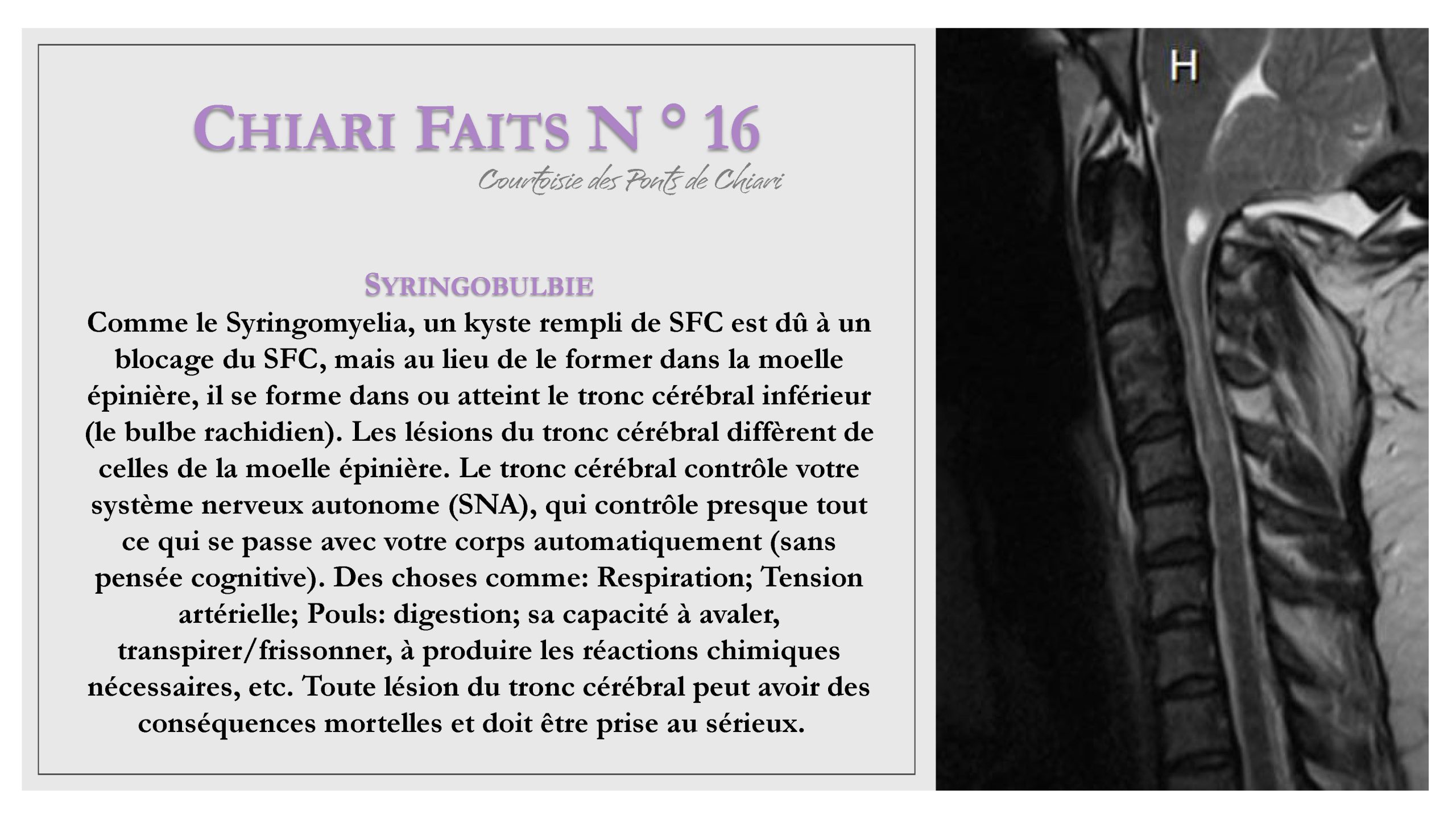 Chiari Faits N ° 16