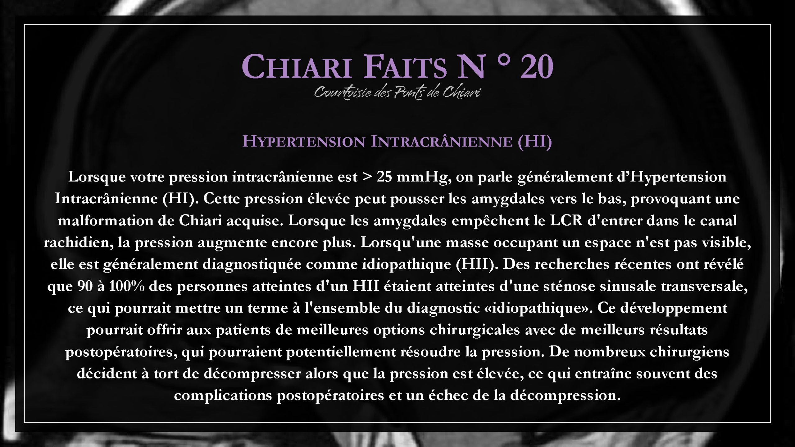 Chiari Faits N ° 20