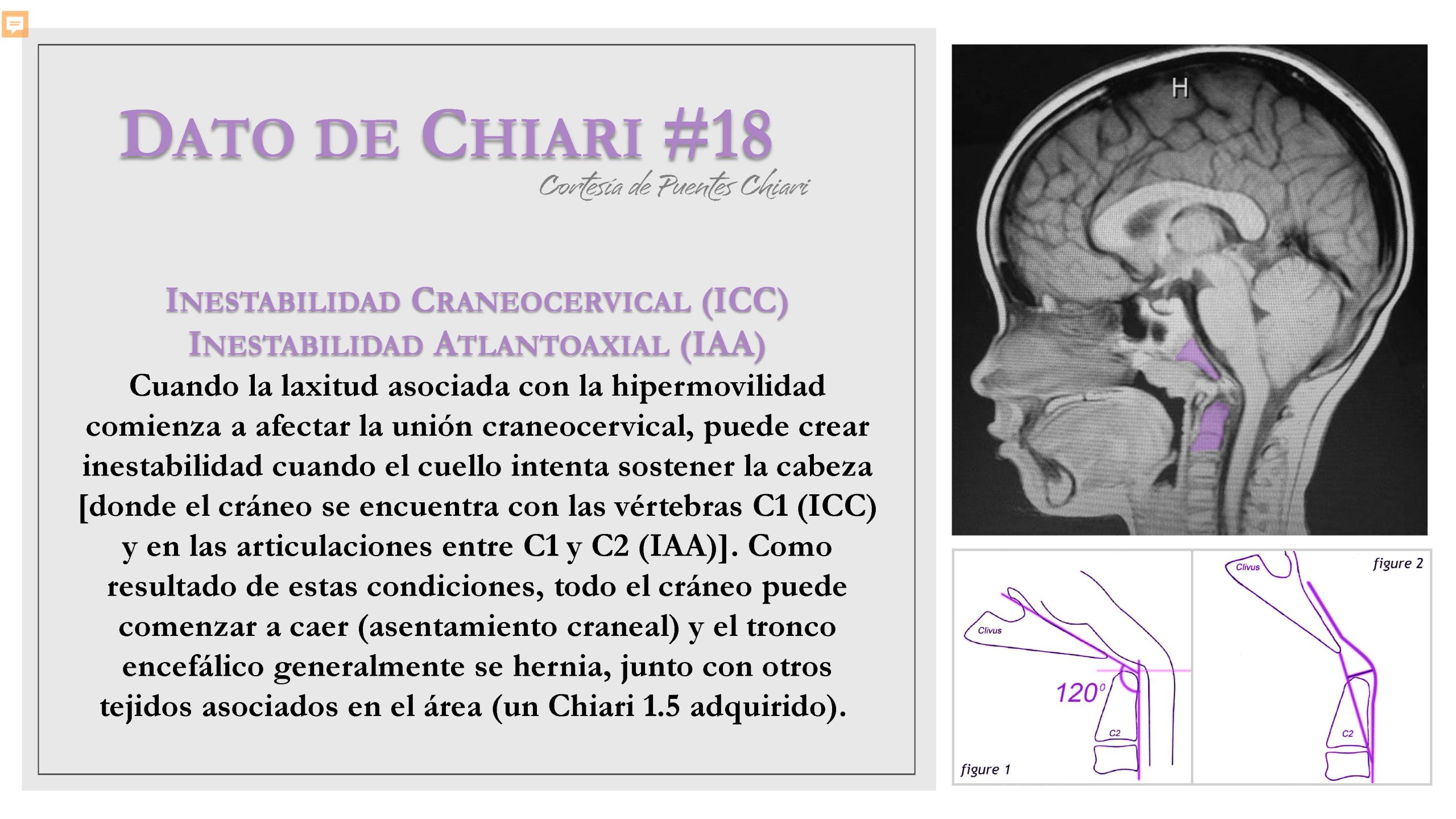 Dato de Chiari #18