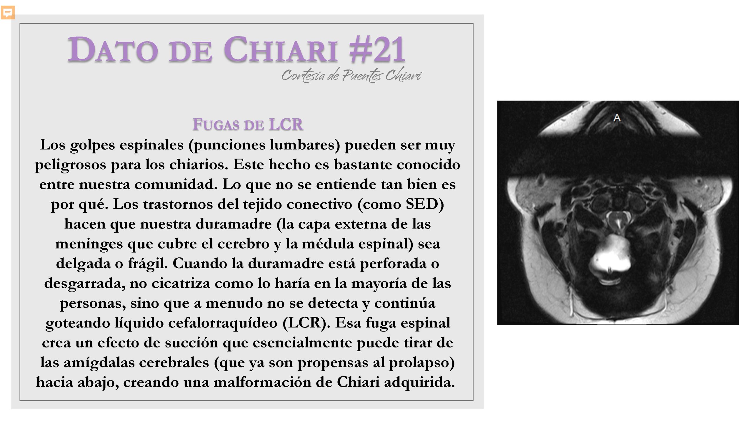 Dato de Chiari #21