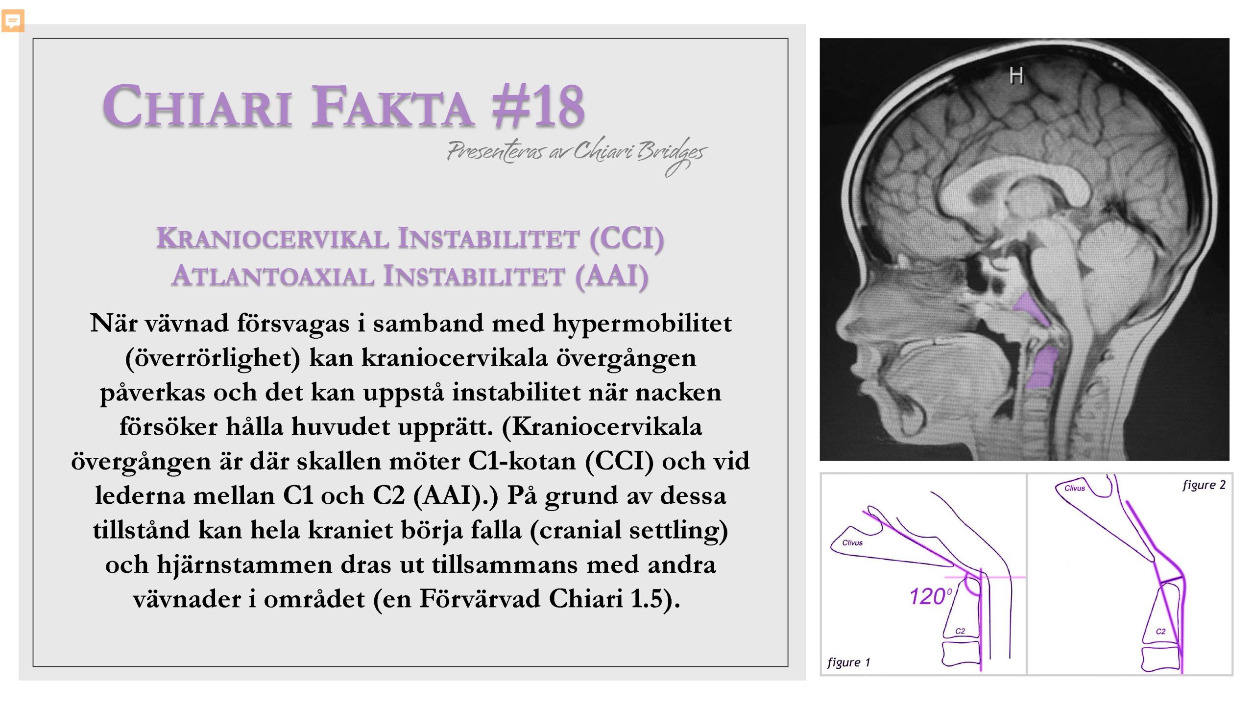 Chiari Fakta #18