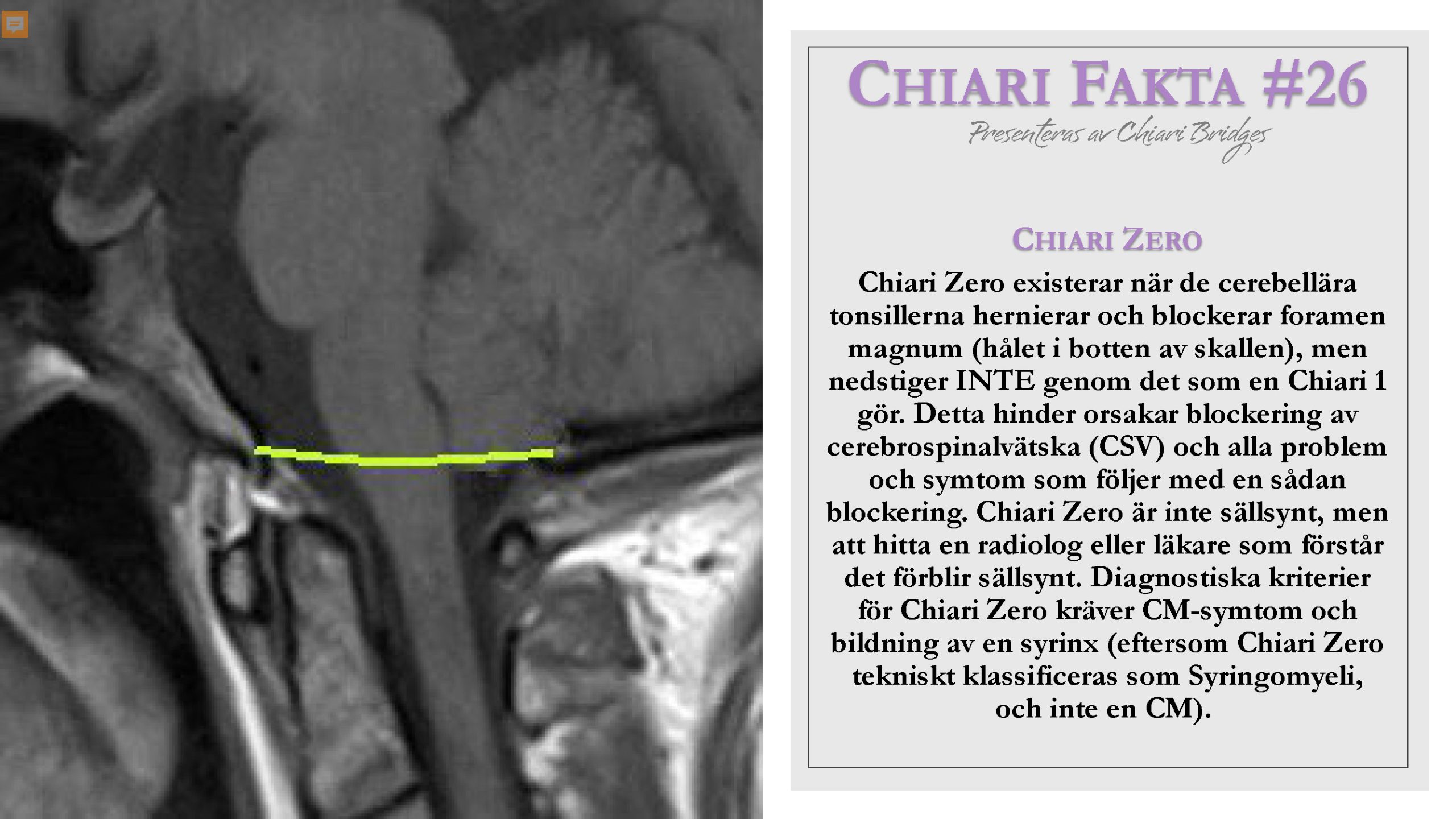 Chiari Fakta #26