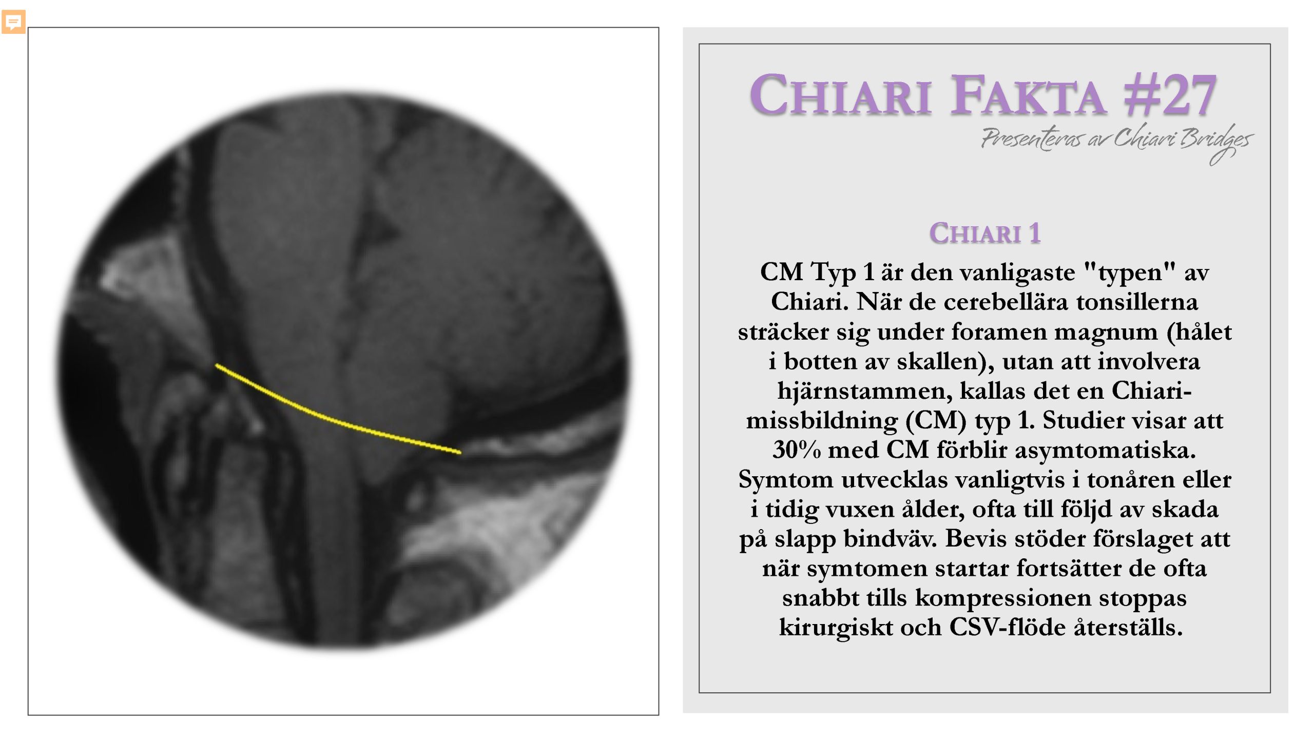 Chiari Fakta #27