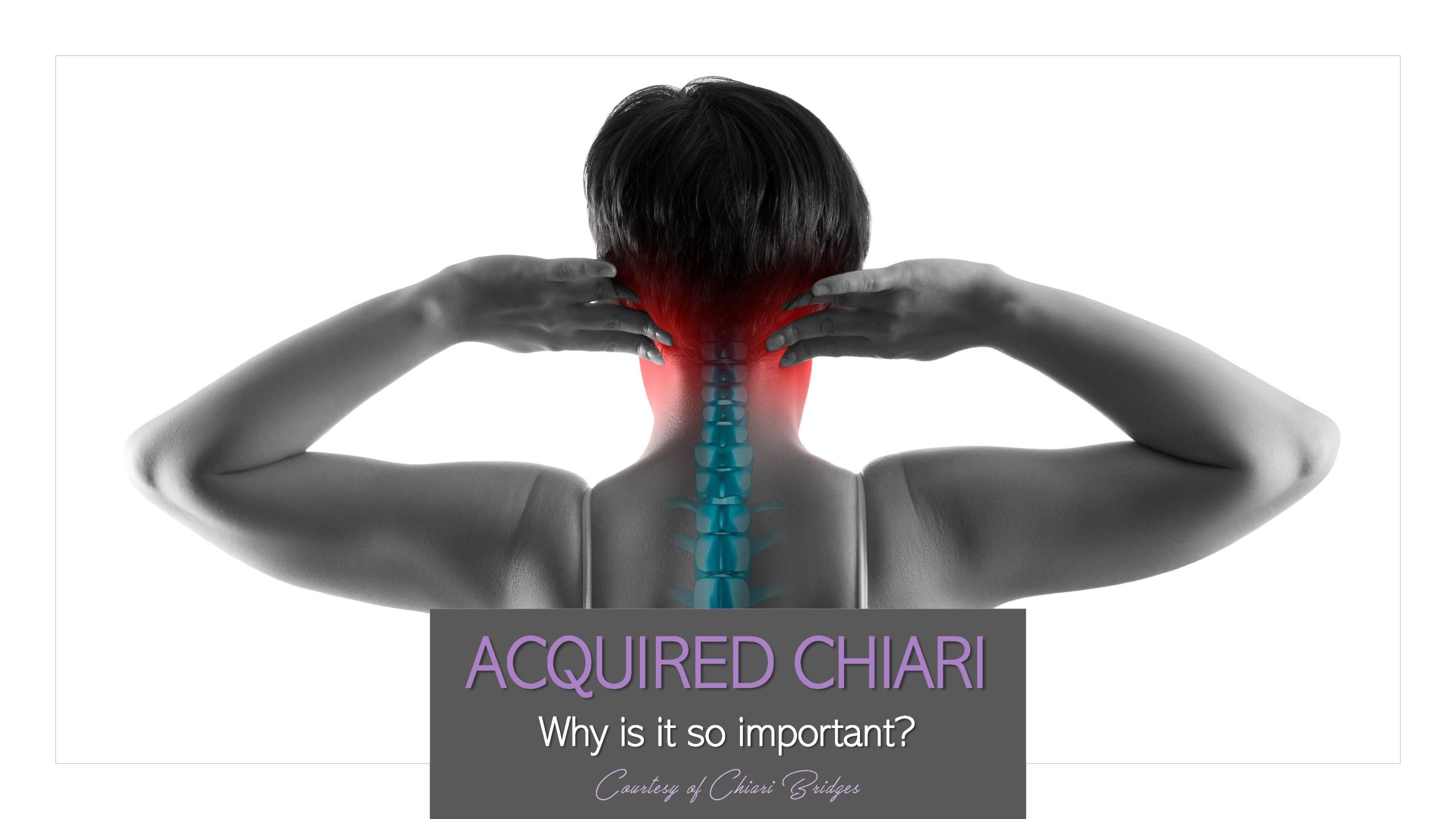 Acquired Chiari, Why is it so important?