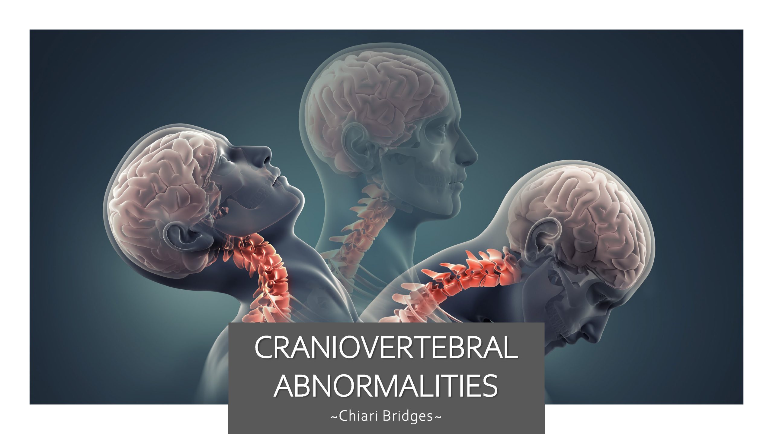 Craniovertebral Abnormalities