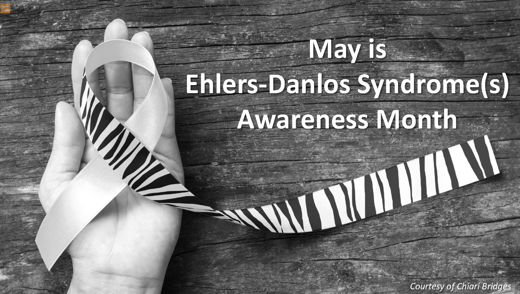 Ehlers-Danlos Syndrome(s) Facts: English