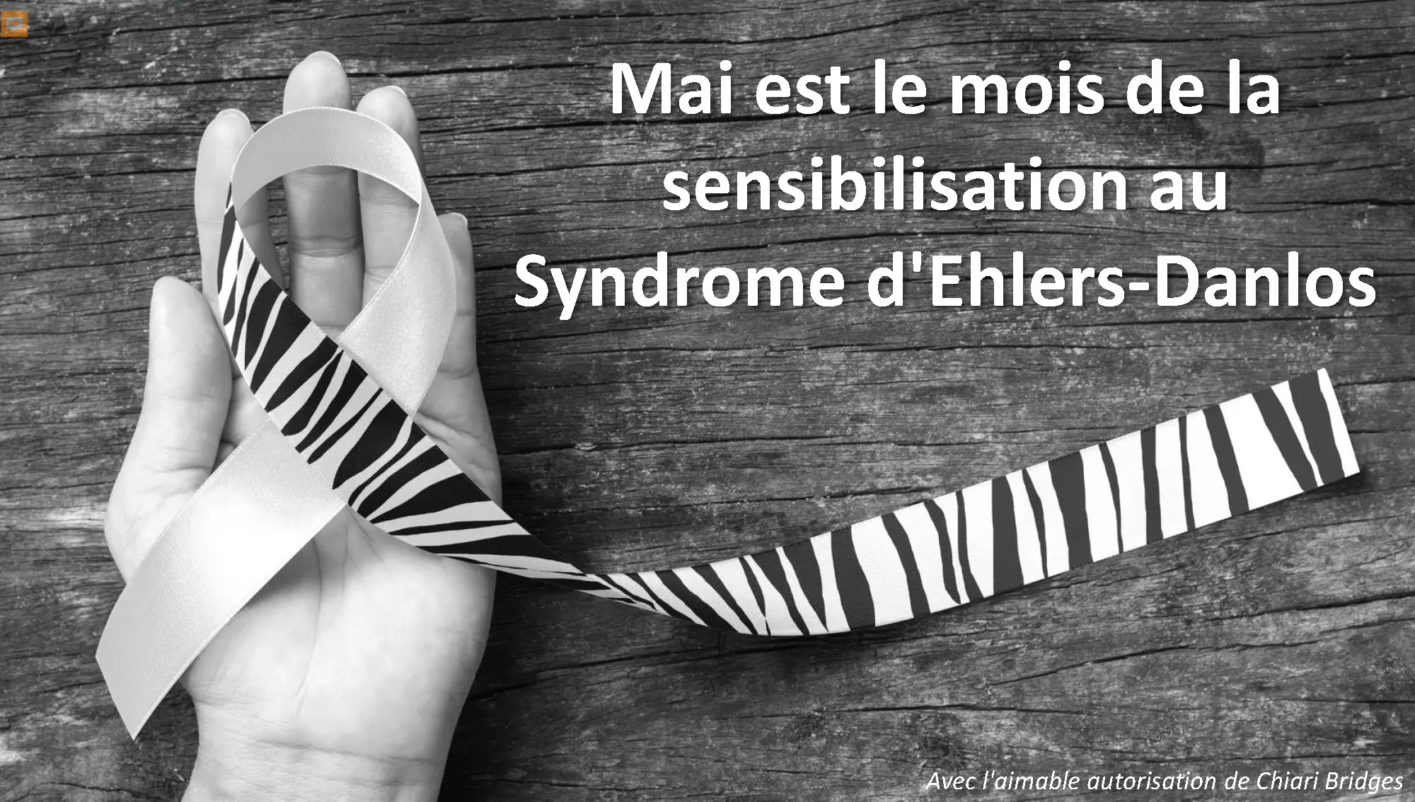 Ehlers-Danlos Syndrome(s) Facts: French