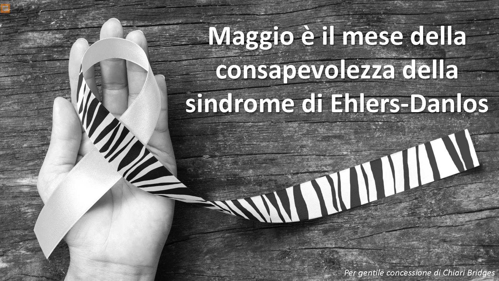 Ehlers-Danlos Syndrome(s) Facts: Italian