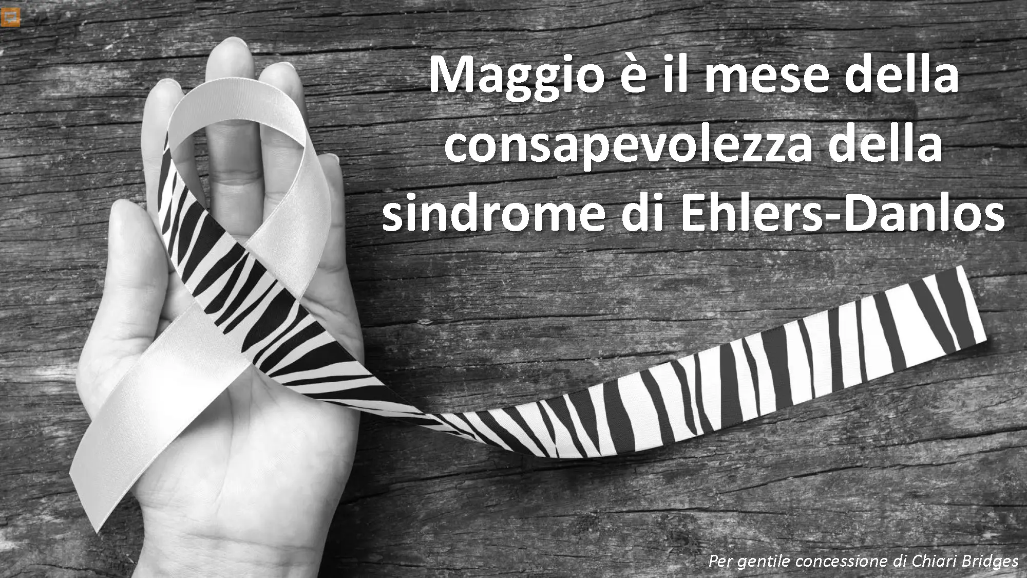 Ehlers-Danlos Syndrome(s) Facts: Italian