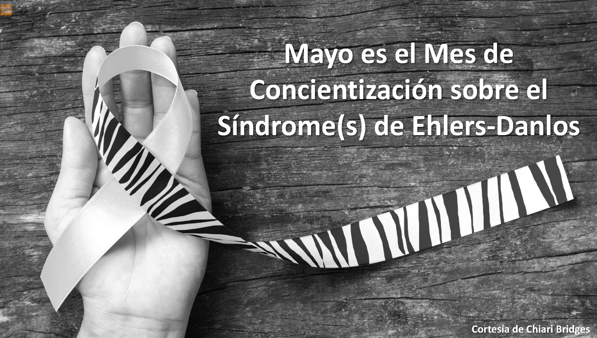 Ehlers-Danlos Syndrome(s) Facts: Spanish