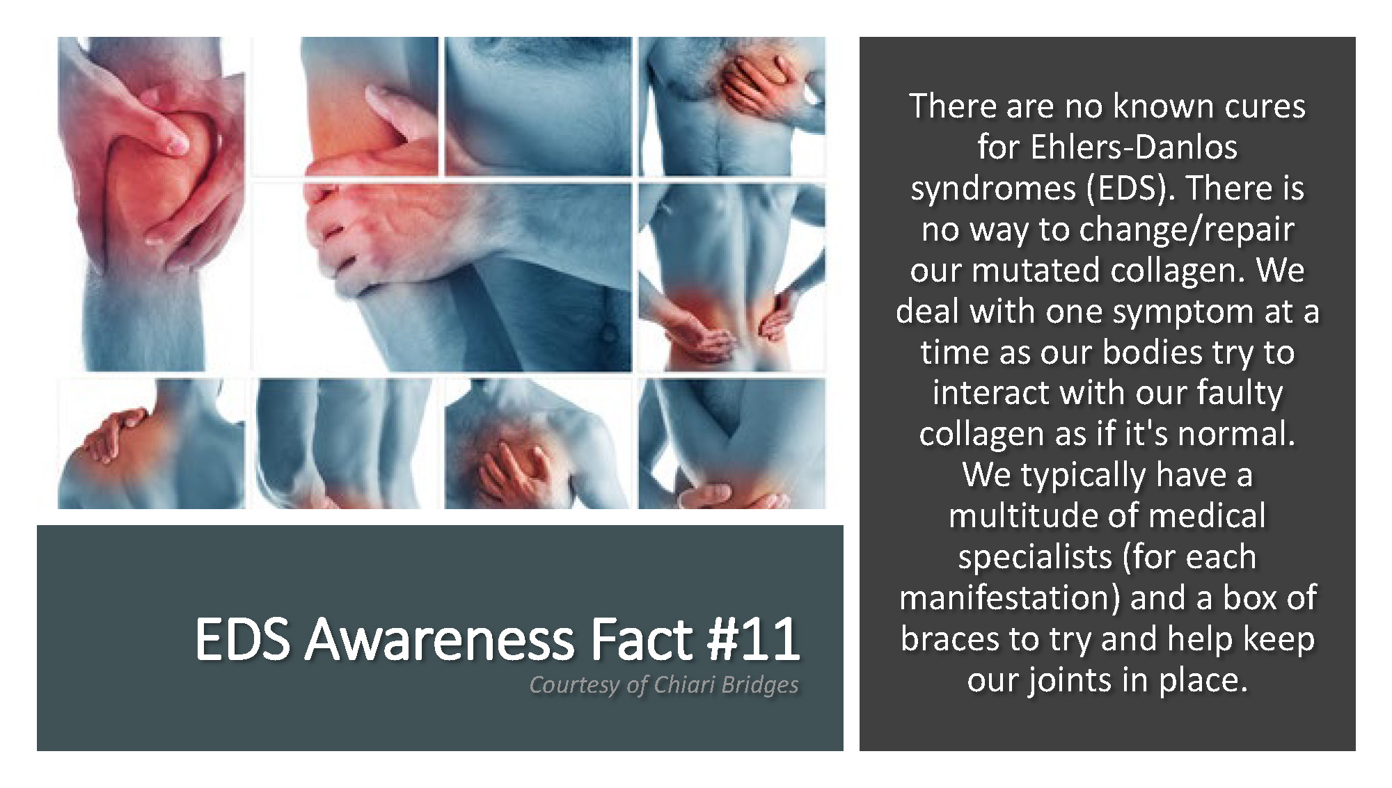 EDS Awareness Fact #11