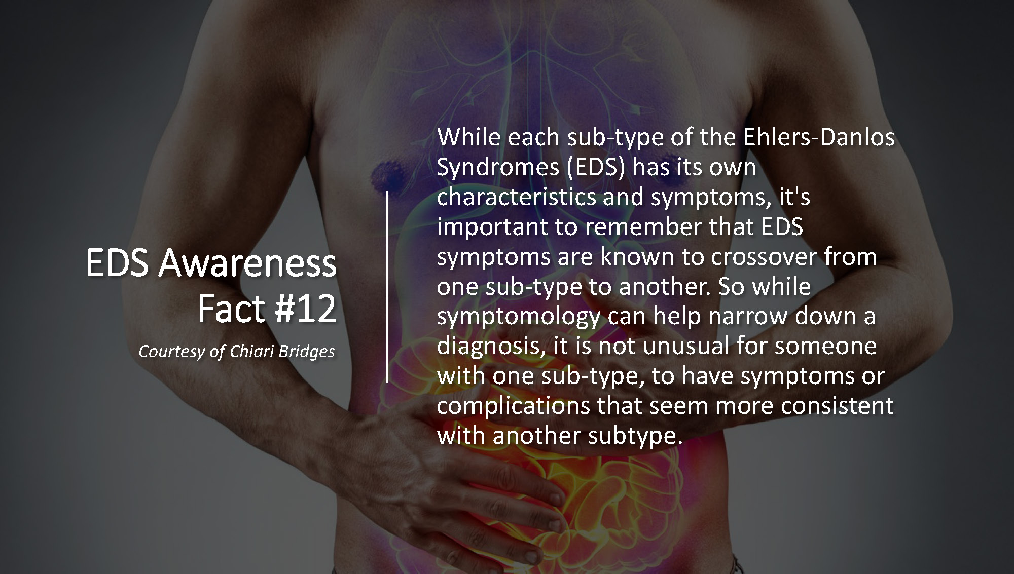 EDS Awareness Fact #12