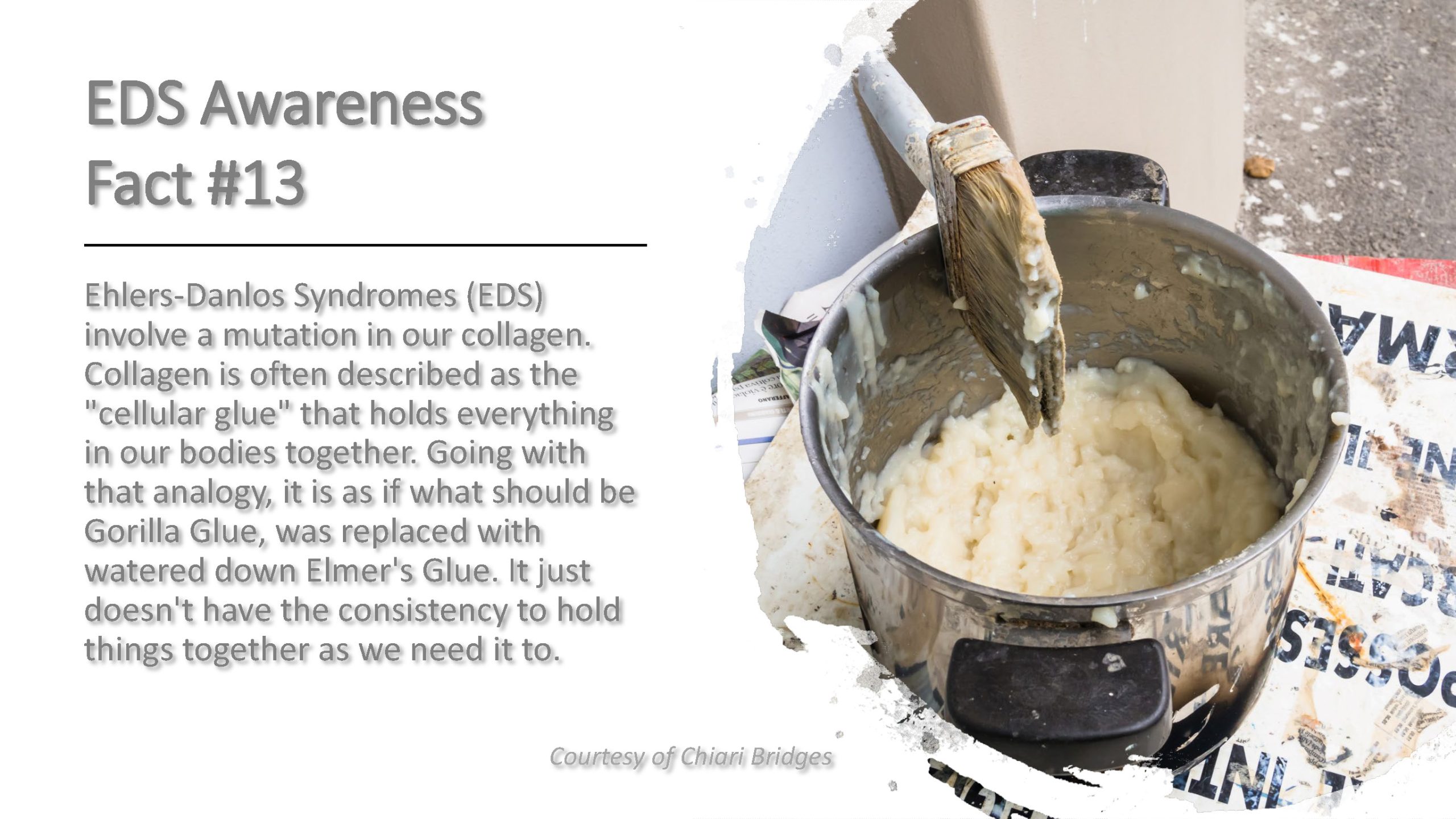 EDS Awareness Fact #13