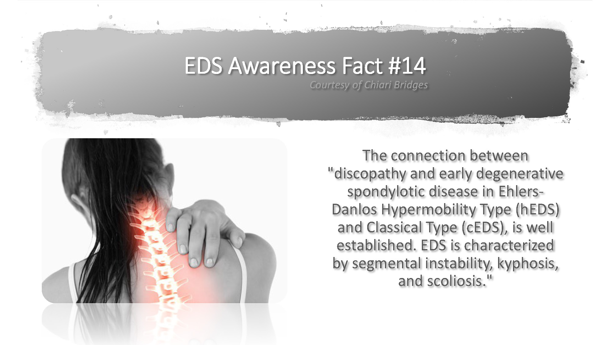 EDS Awareness Fact #14