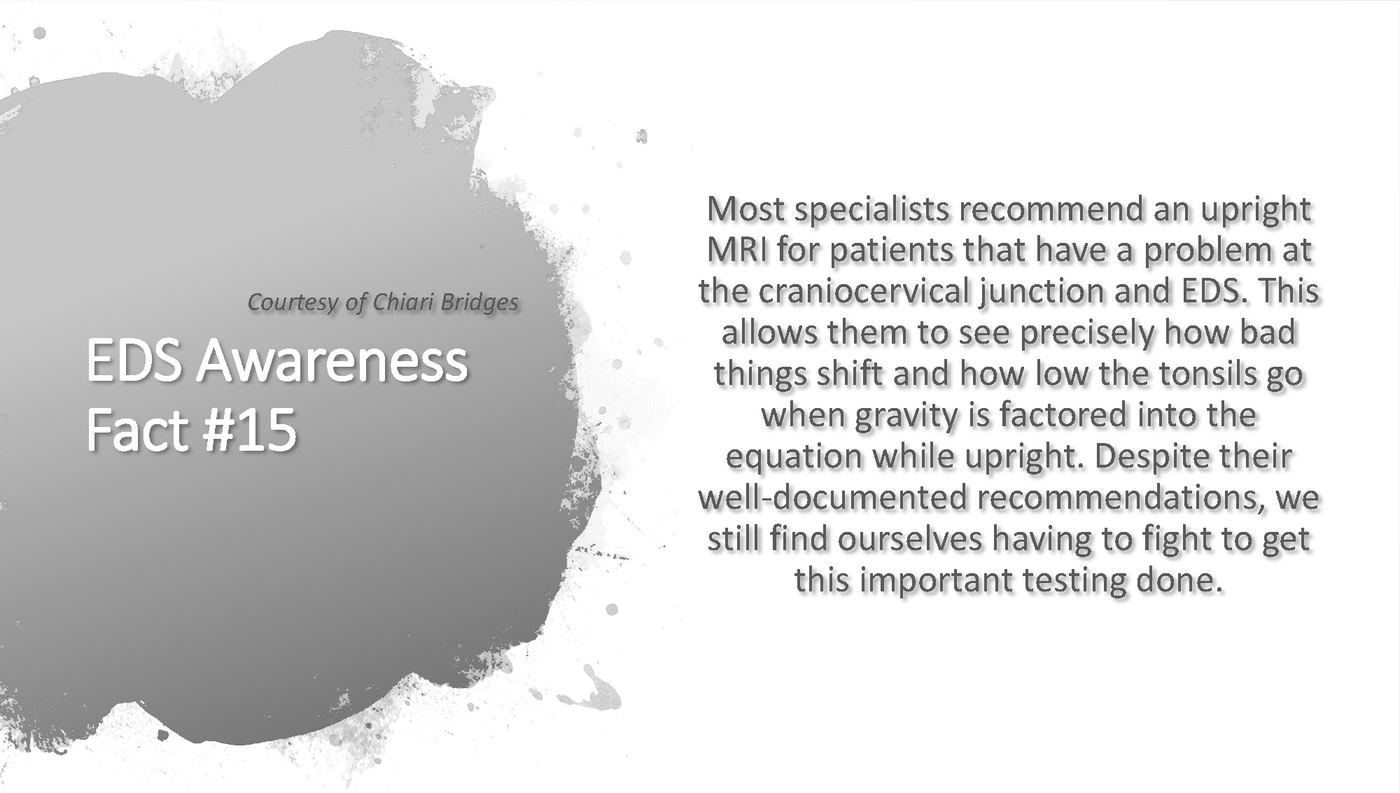 EDS Awareness Fact #15
