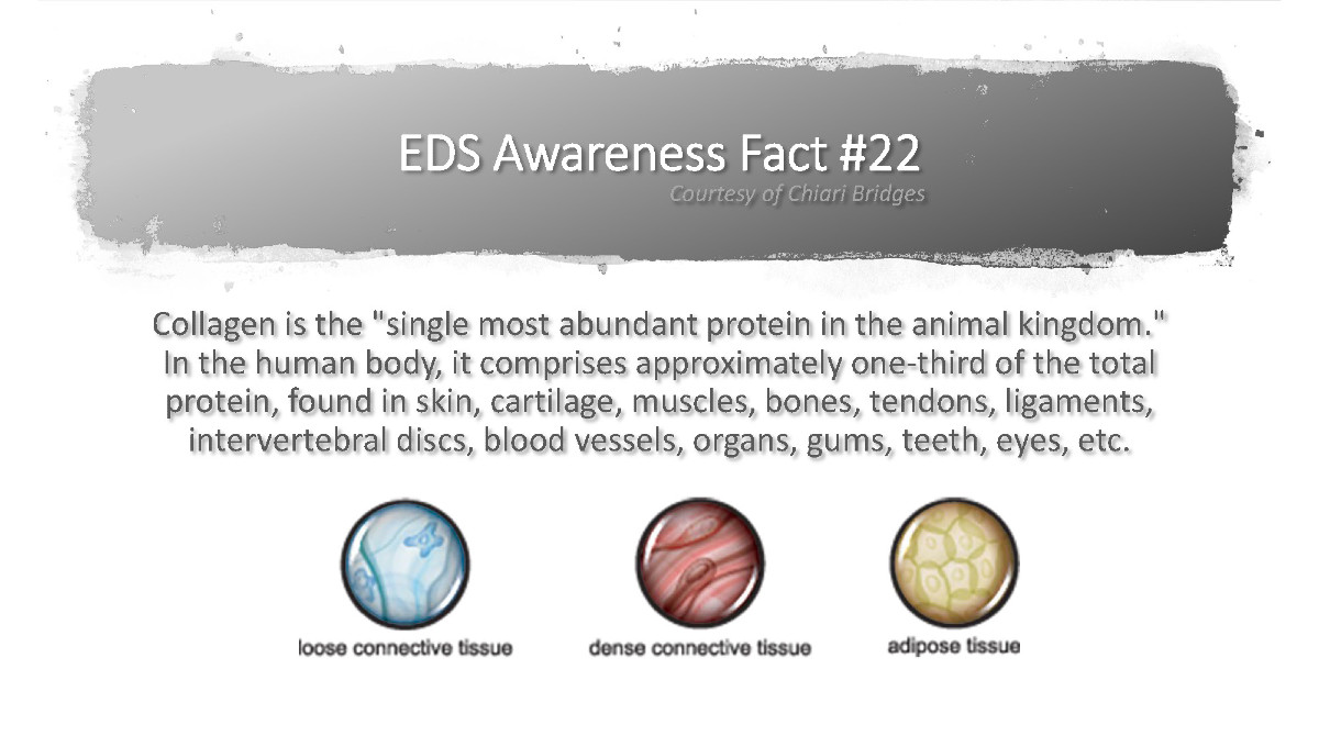 EDS Awareness Fact #22