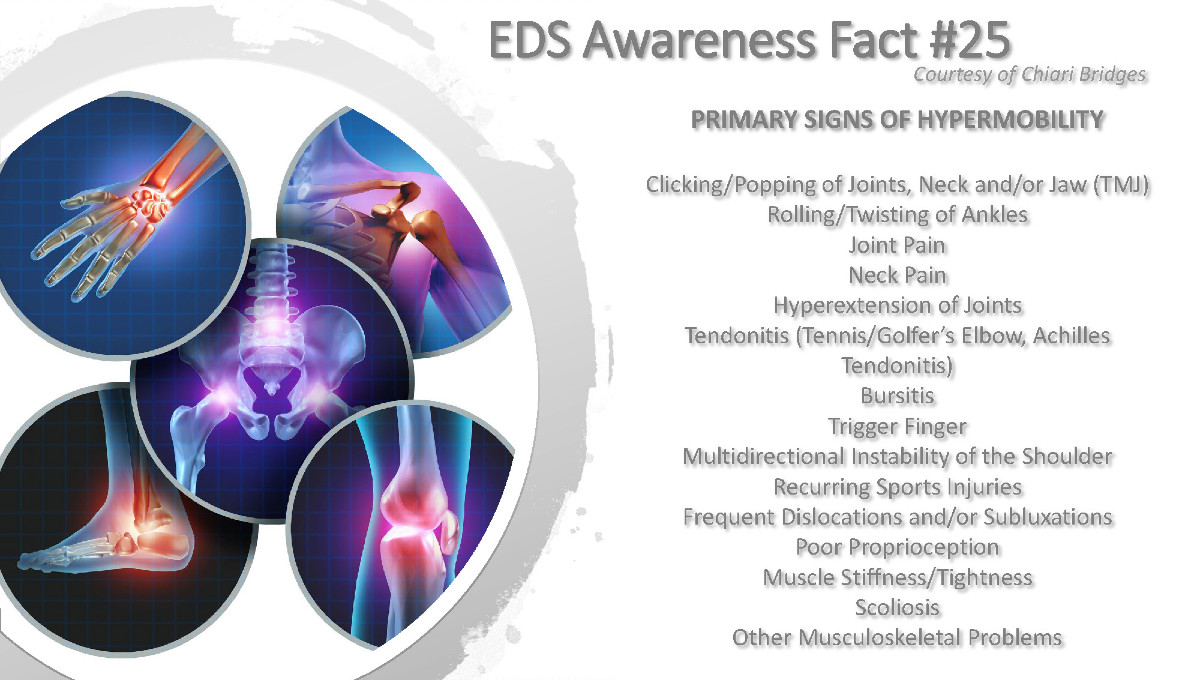 EDS Awareness Fact #25