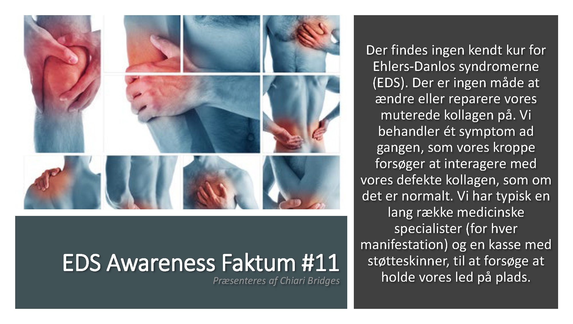 EDS Awareness Faktum #11