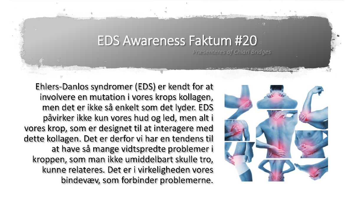 EDS Awareness Faktum #20