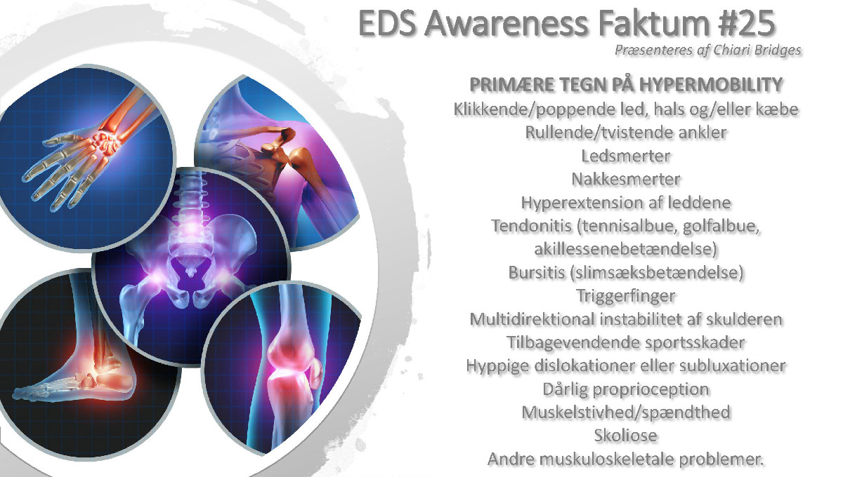 EDS Awareness Faktum #25