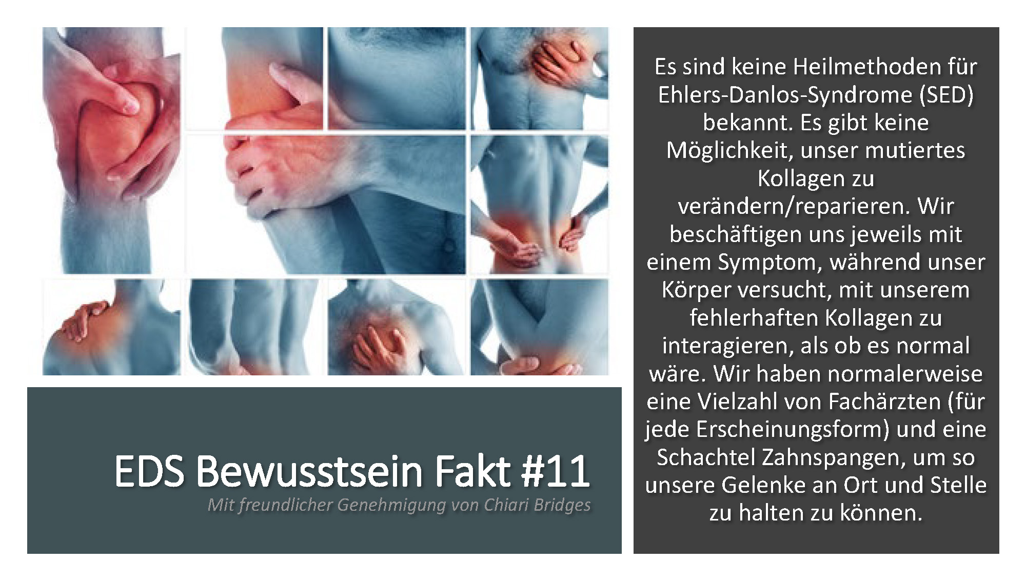 EDS Bewusstsein Fakt #11