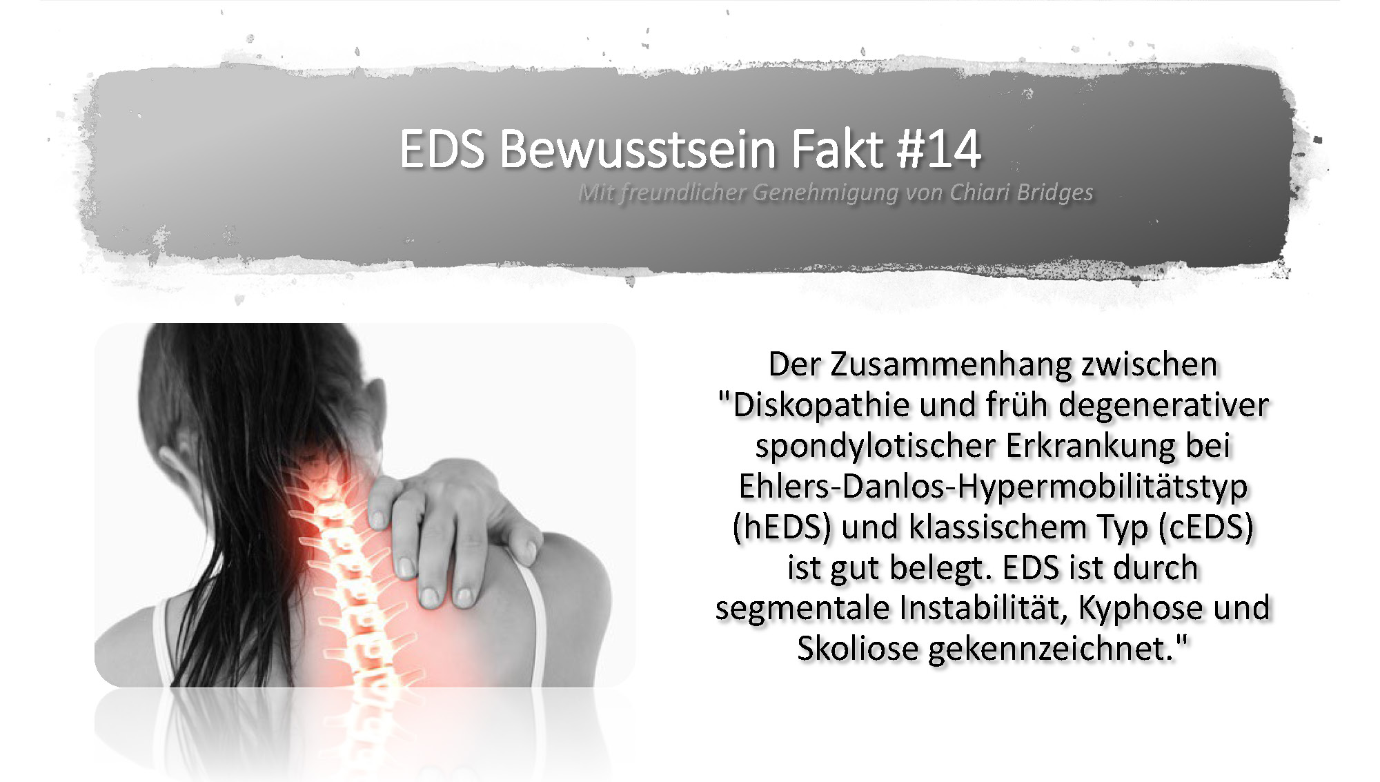 EDS Bewusstsein Fakt #14