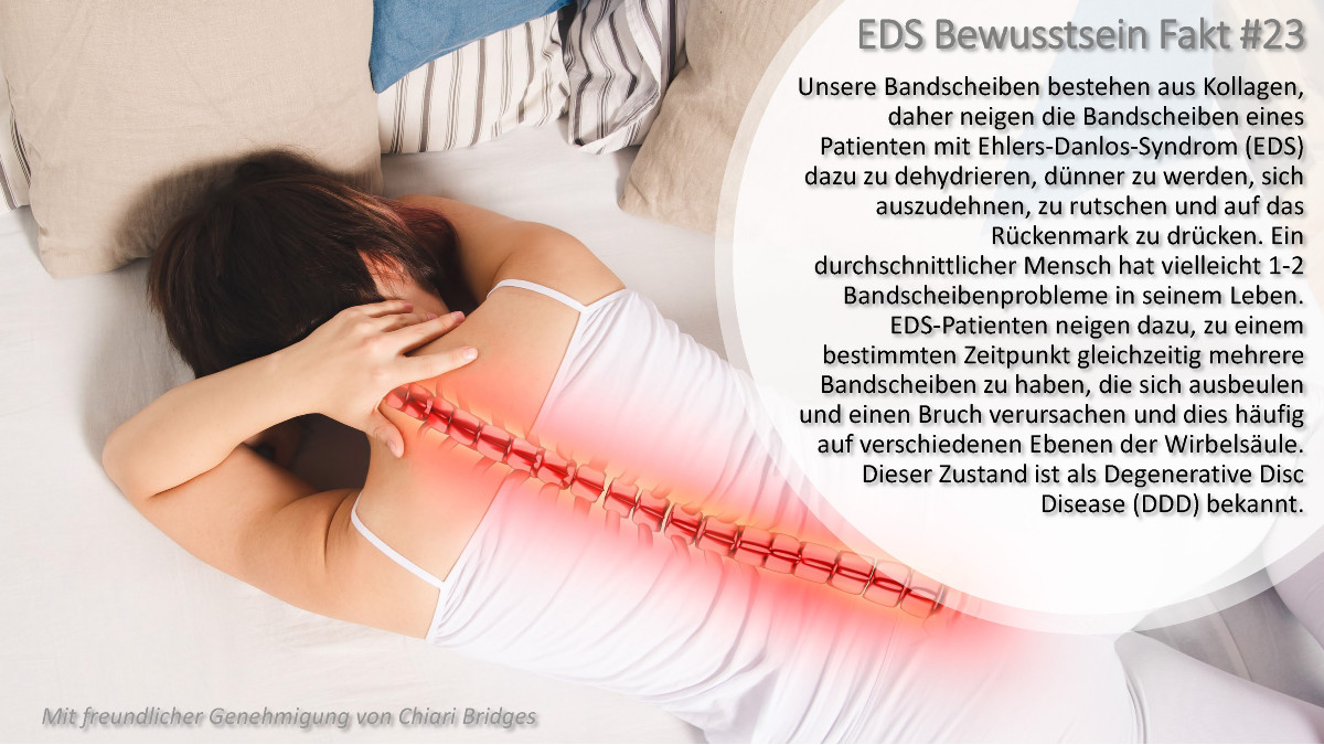 EDS Bewusstsein Fakt #23