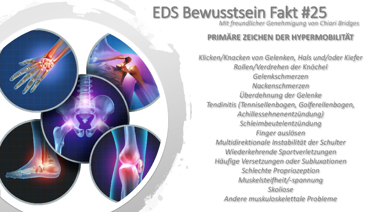 EDS Bewusstsein Fakt #25