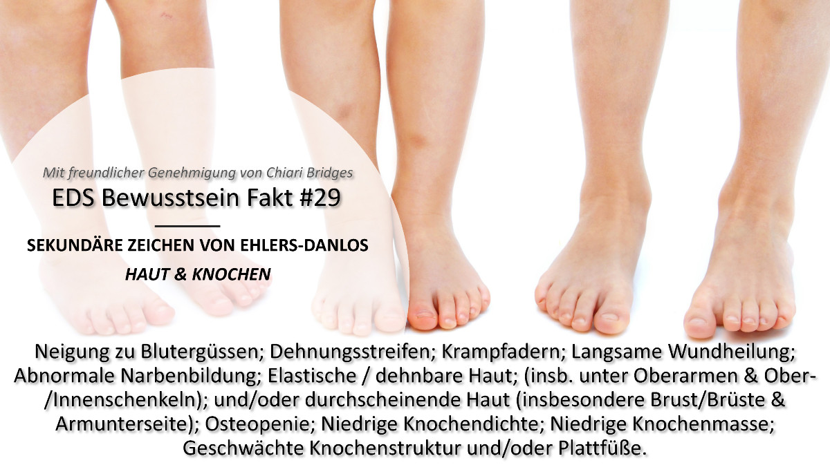 EDS Bewusstsein Fakt #29