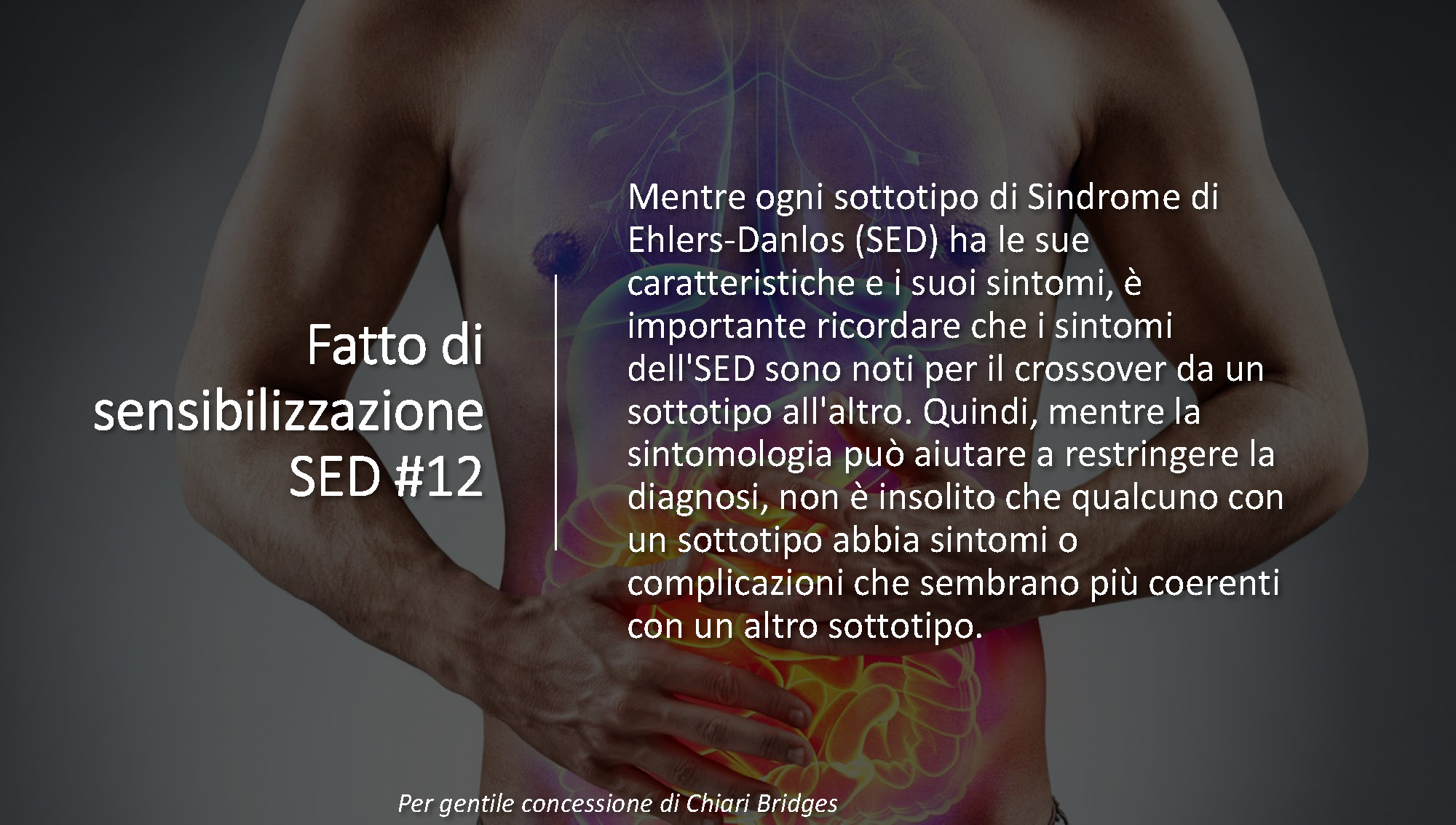Fatto di sensibilizzazione SED #12