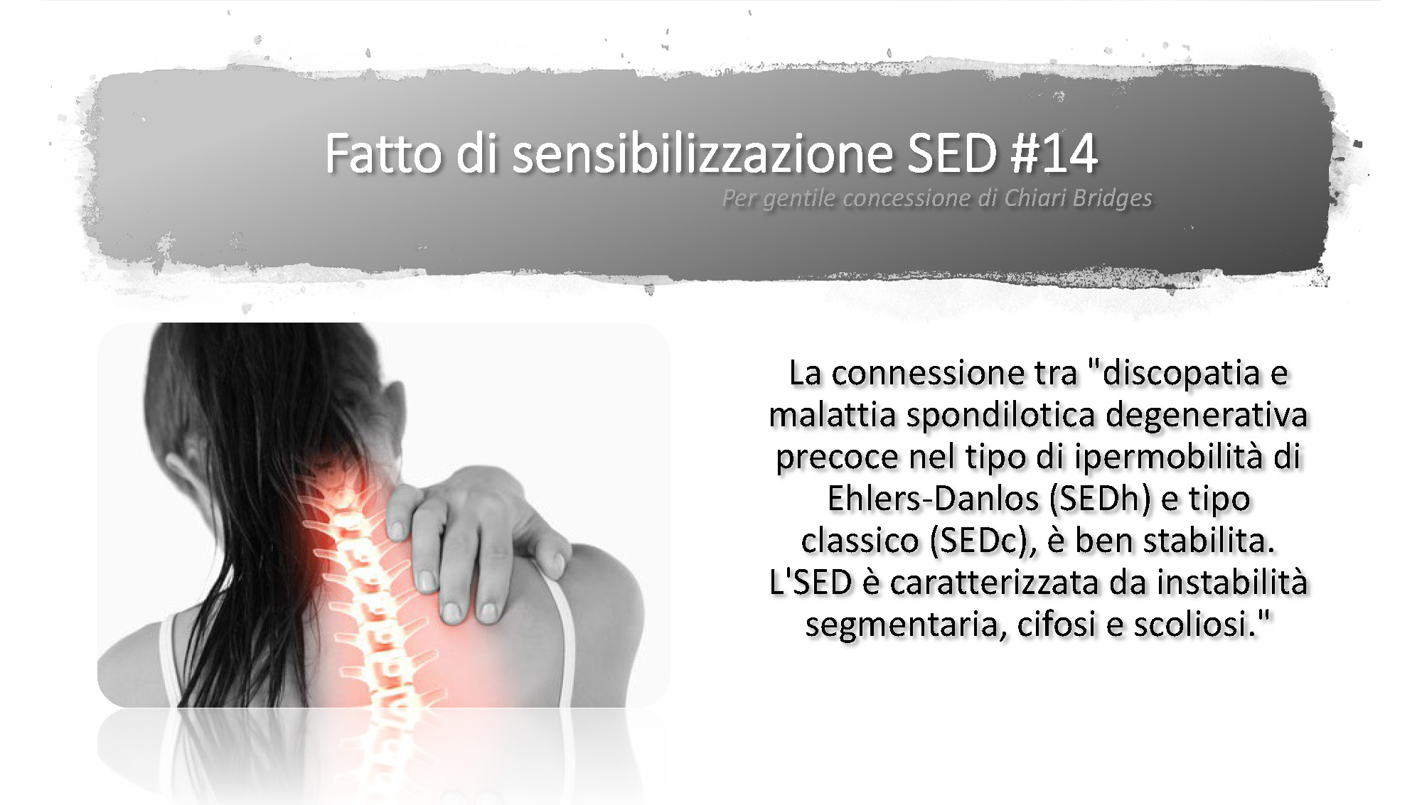 Fatto di sensibilizzazione SED #14