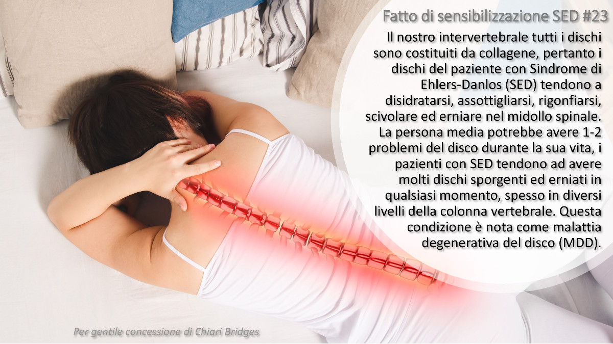 Fatto di sensibilizzazione SED #23