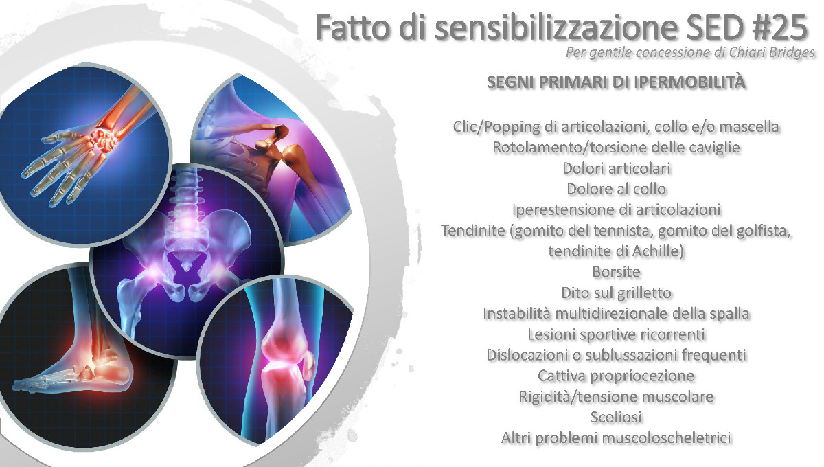 Fatto di sensibilizzazione SED #25