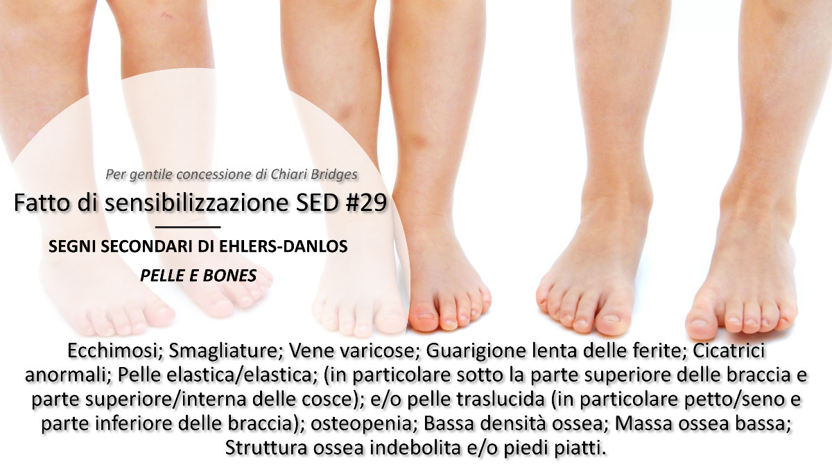 Fatto di sensibilizzazione SED #29