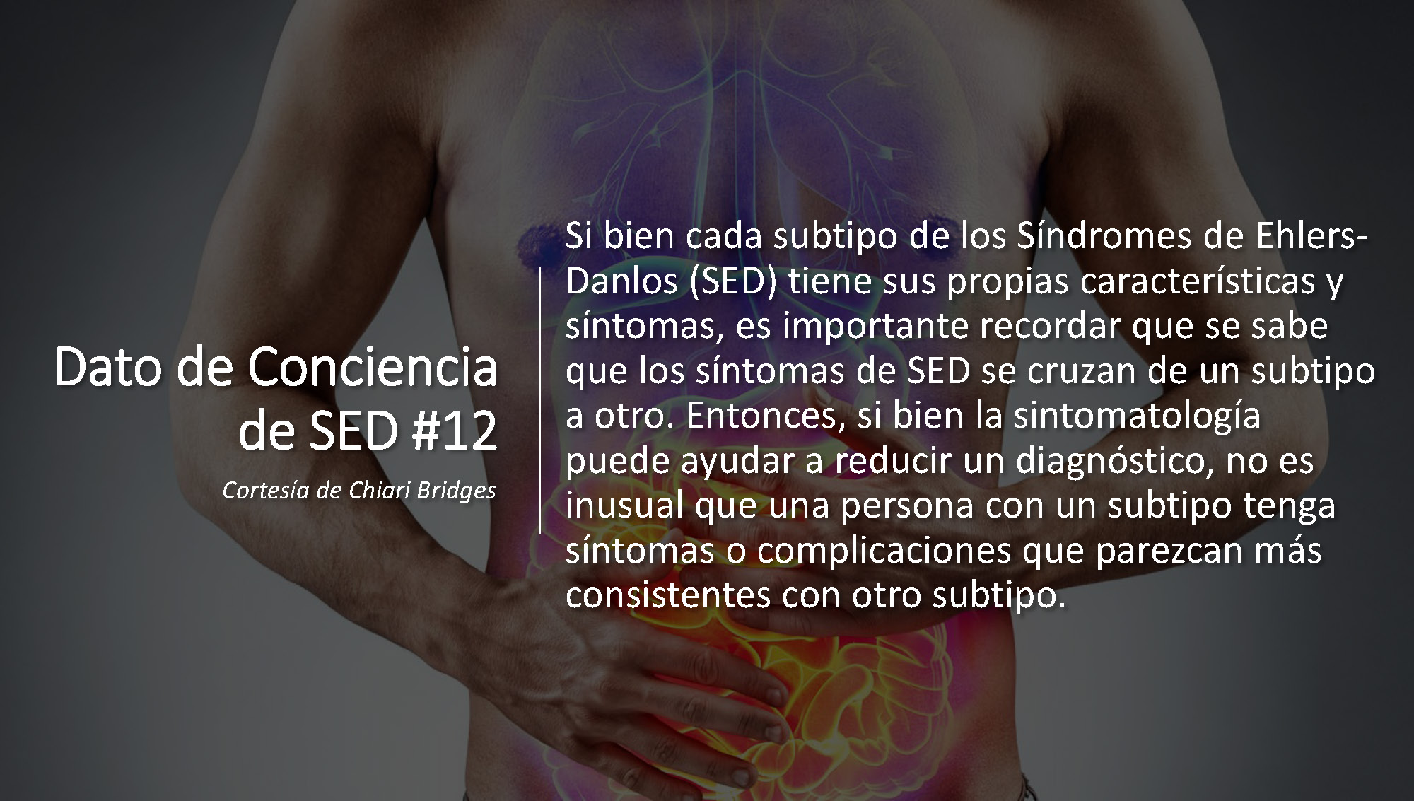 Dato de conciencia de SED #12
