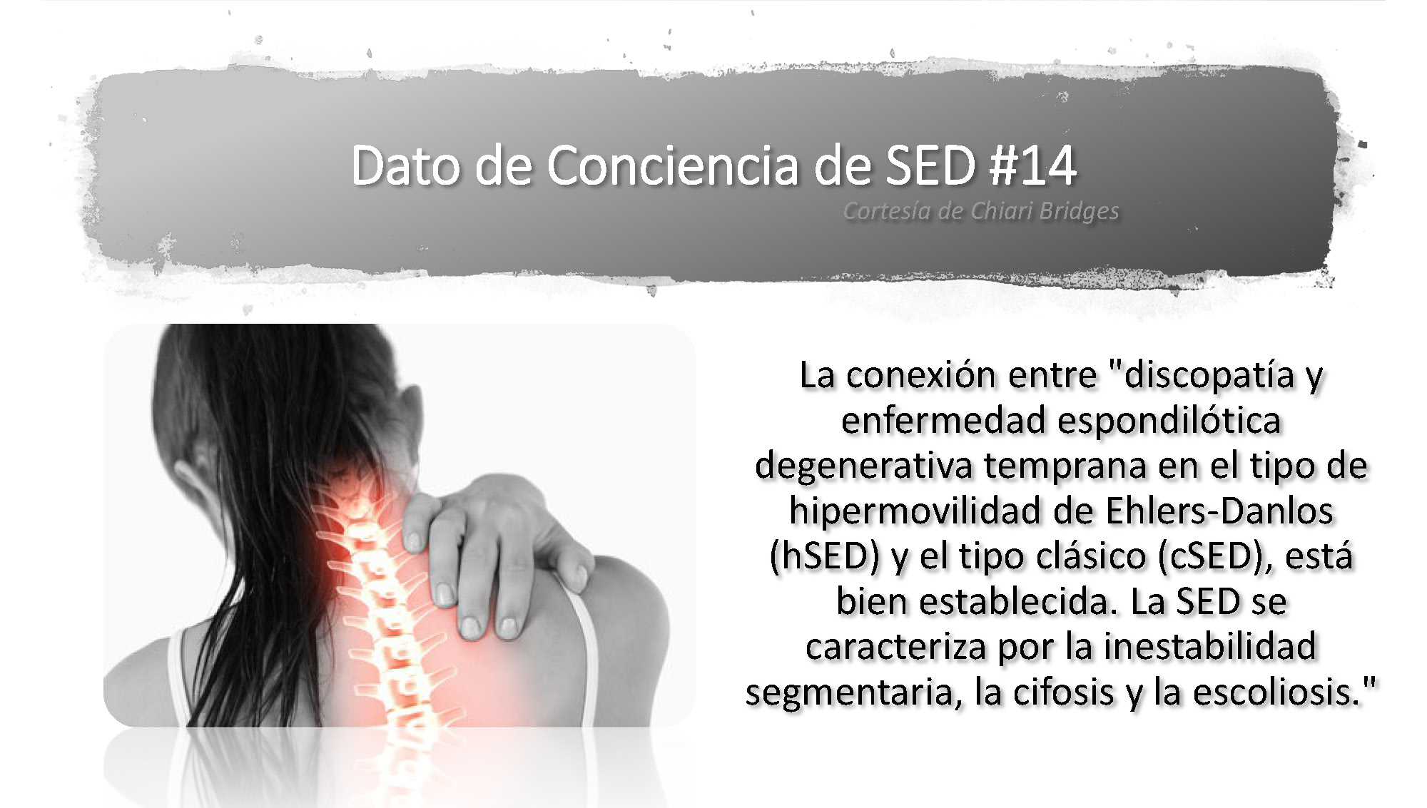 Dato de conciencia de SED #14