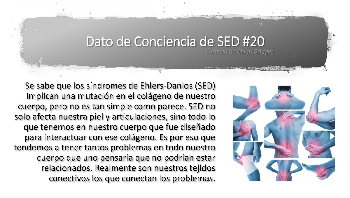 Dato de conciencia de SED #20