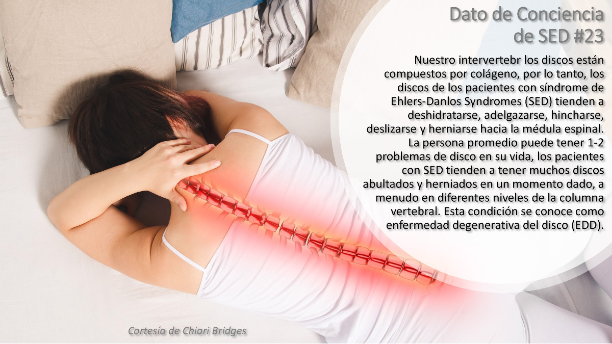 Dato de conciencia de SED #23